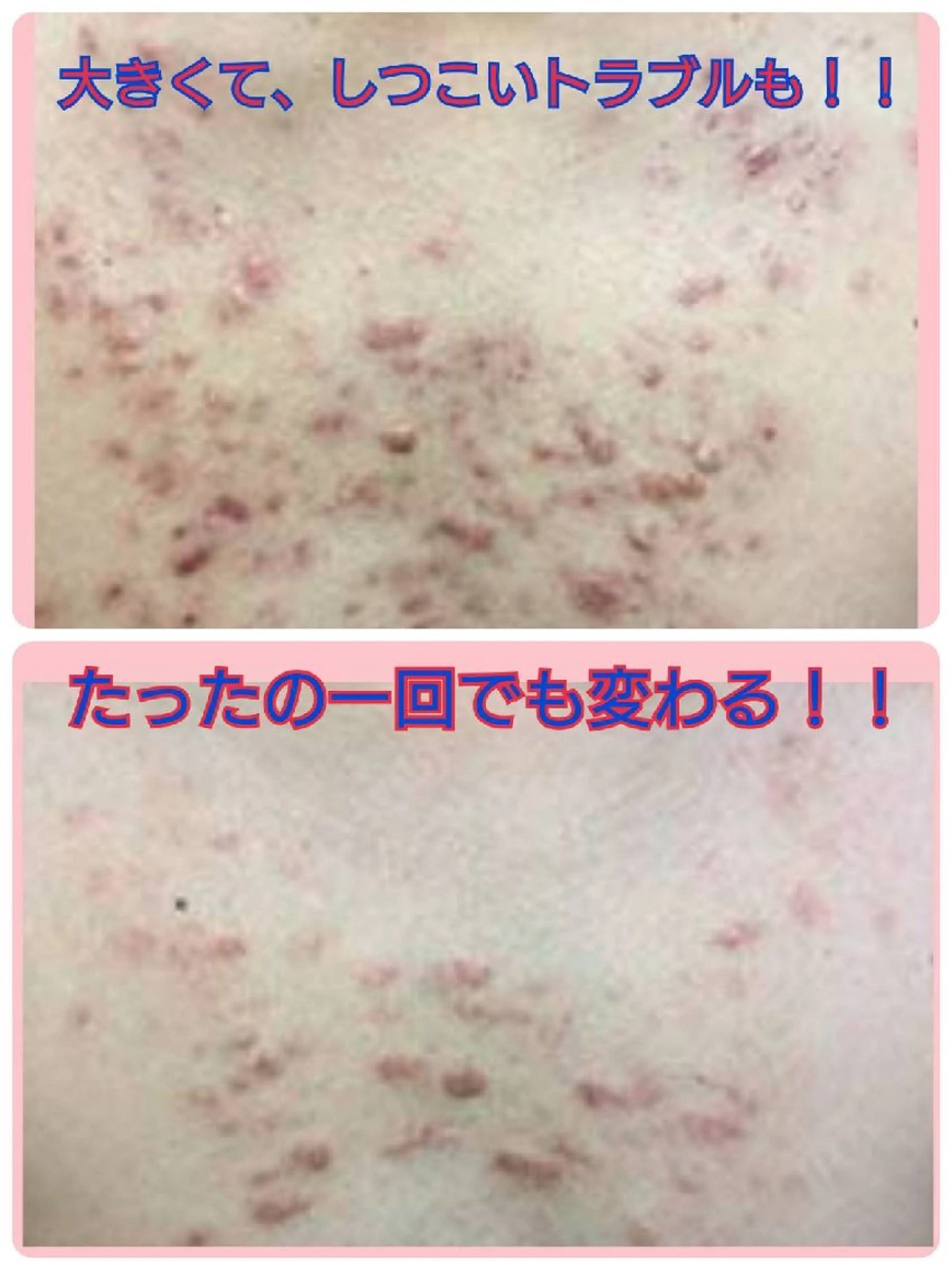 エステ ハーブピーリング 専門店Kikkaのエステ・リラクイメージ