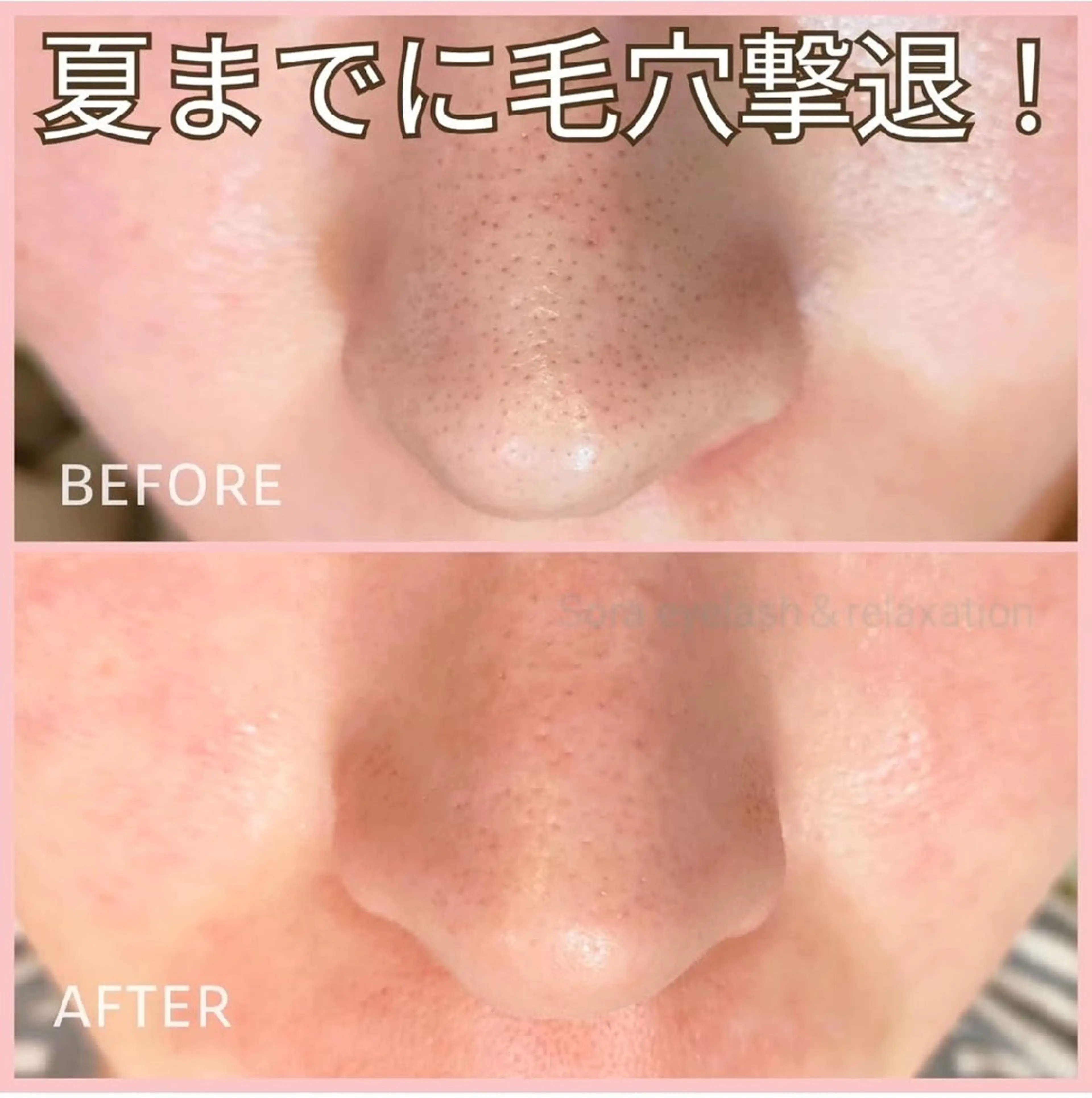 Sora. なるみのマツエク・マツパデザイン