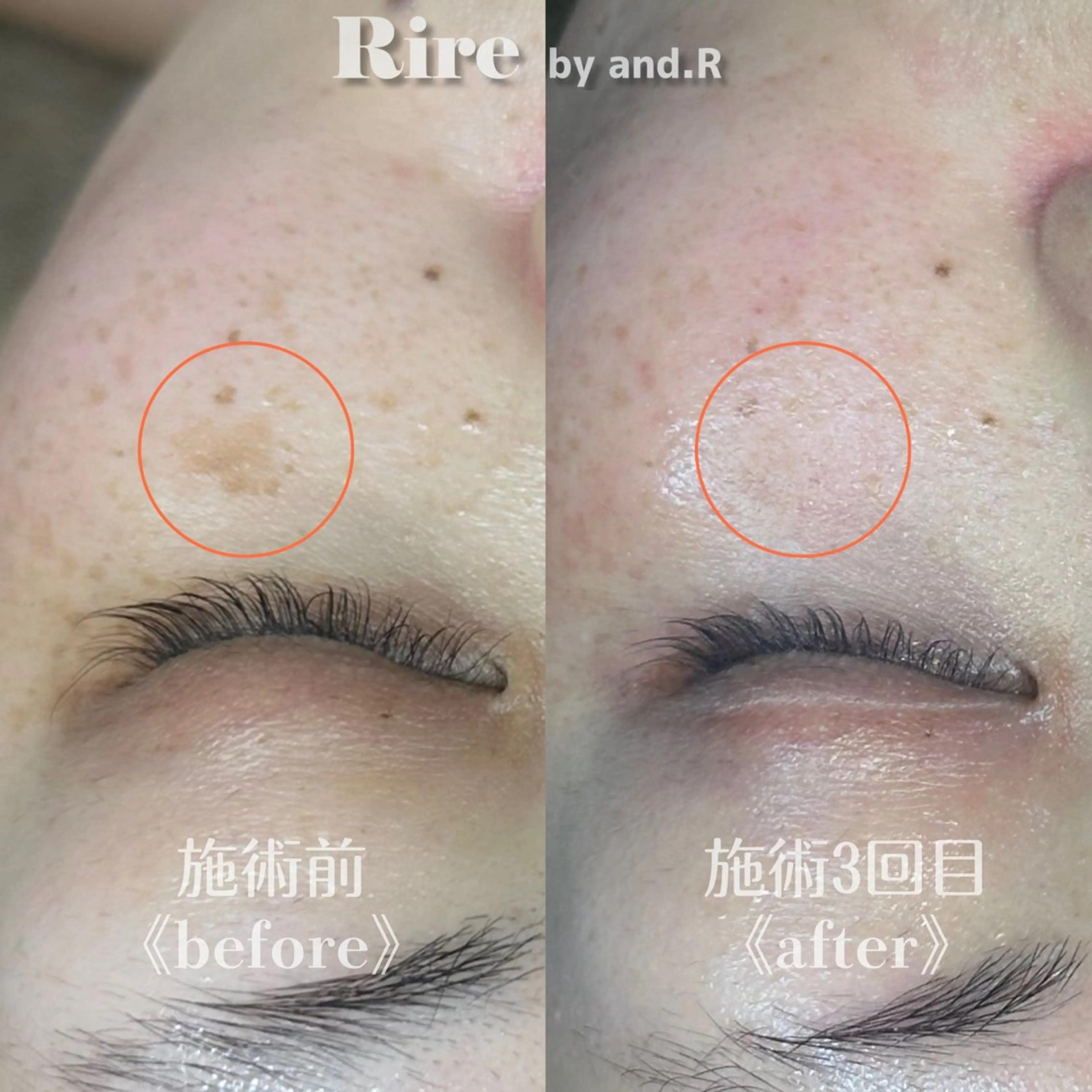 実方 梨々花のエステ・リラクイメージ