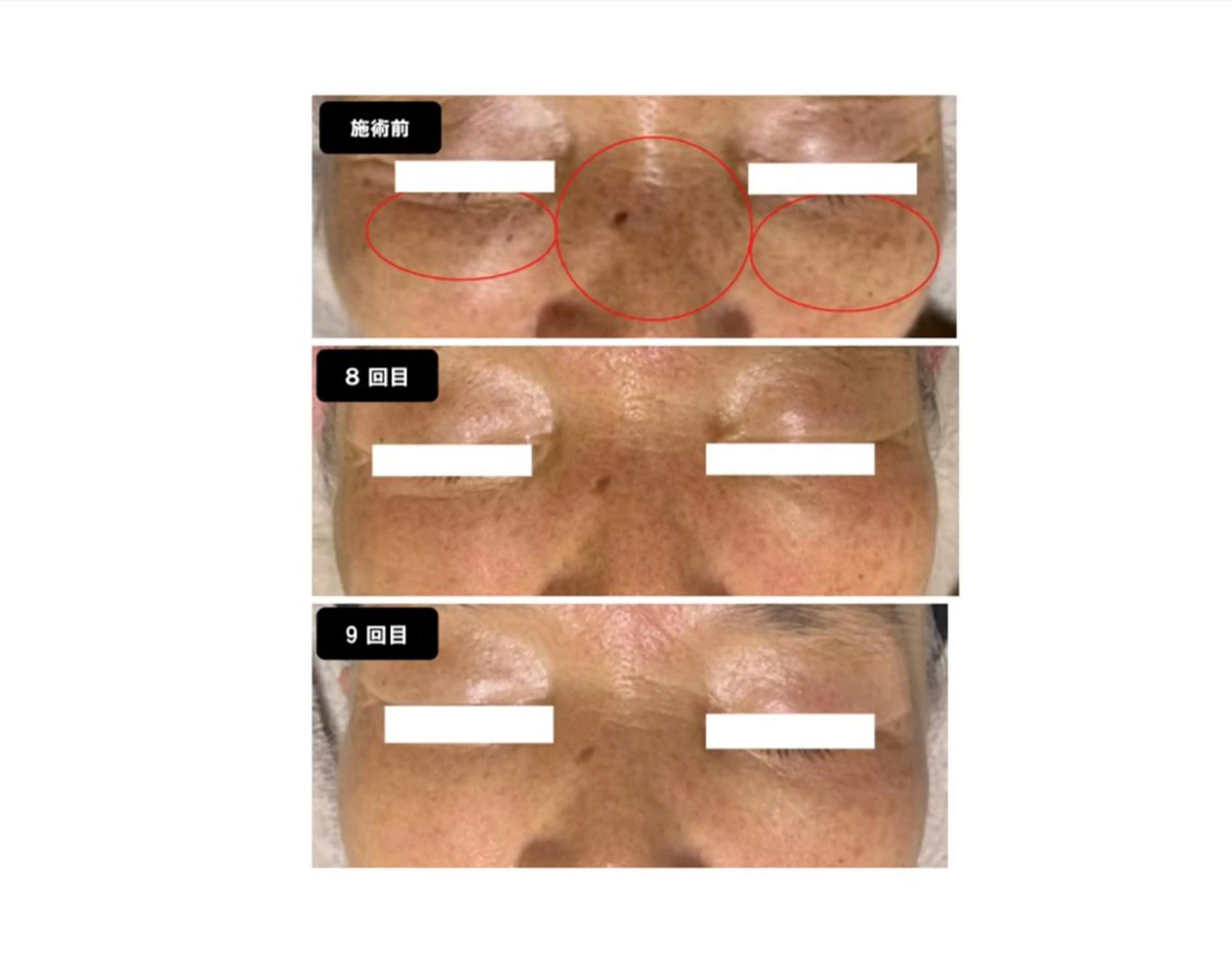 エステ ヴィーナス ビューティーのエステ・リラクイメージ