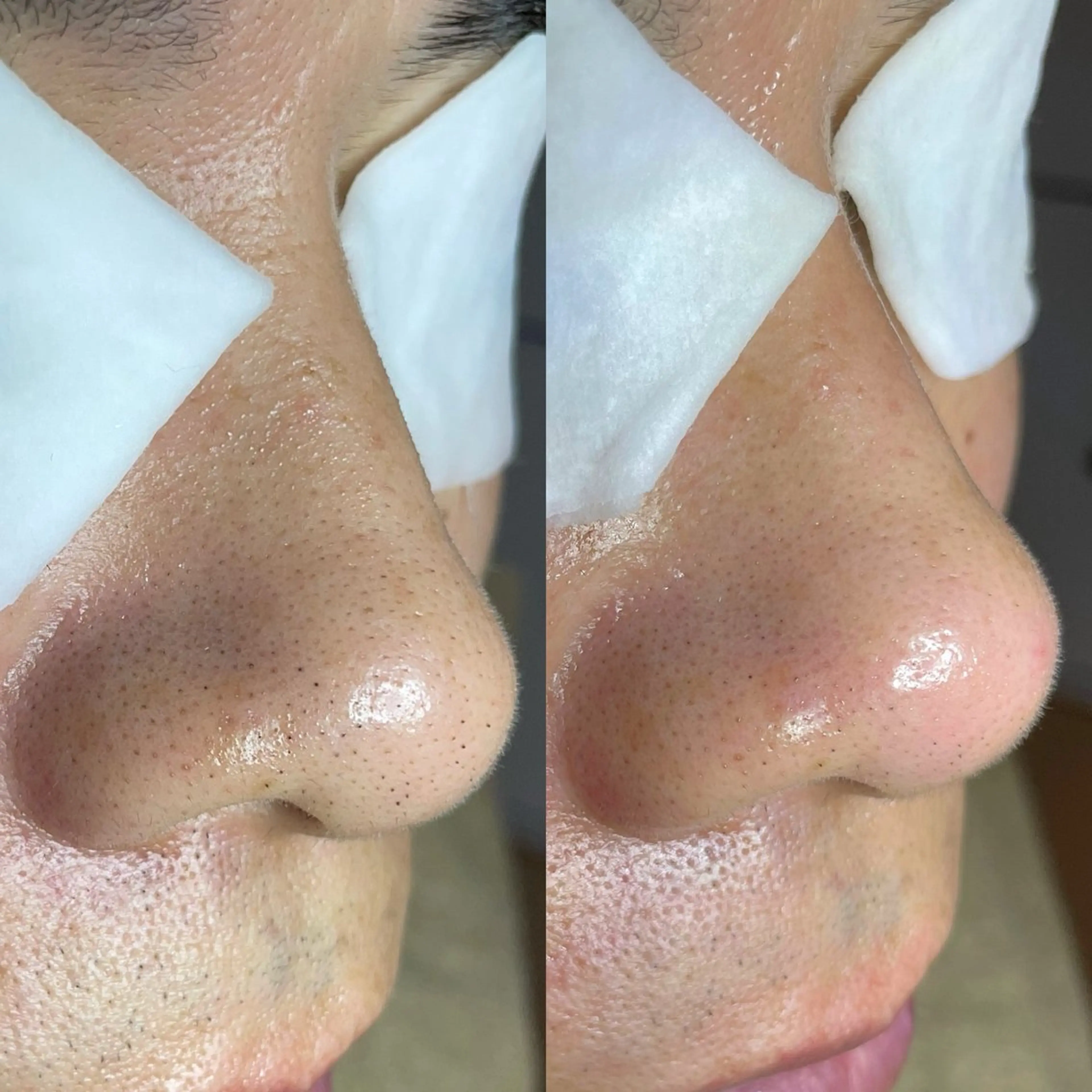 エステ Re:Belle 久留米 : 中島のエステ・リラクイメージ