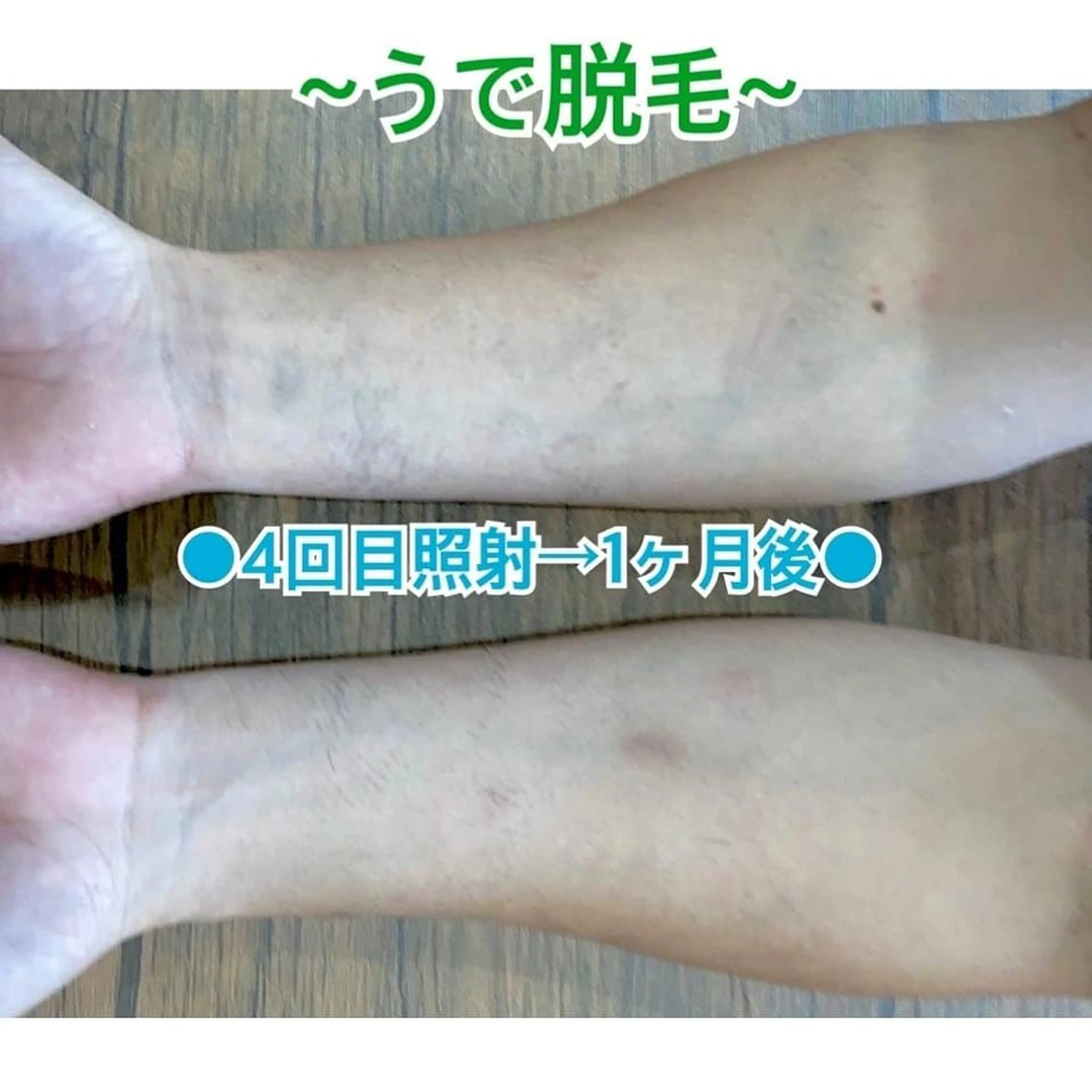 メンズ キッズ 脱毛 BiSTA ヒロのエステ・リラクイメージ