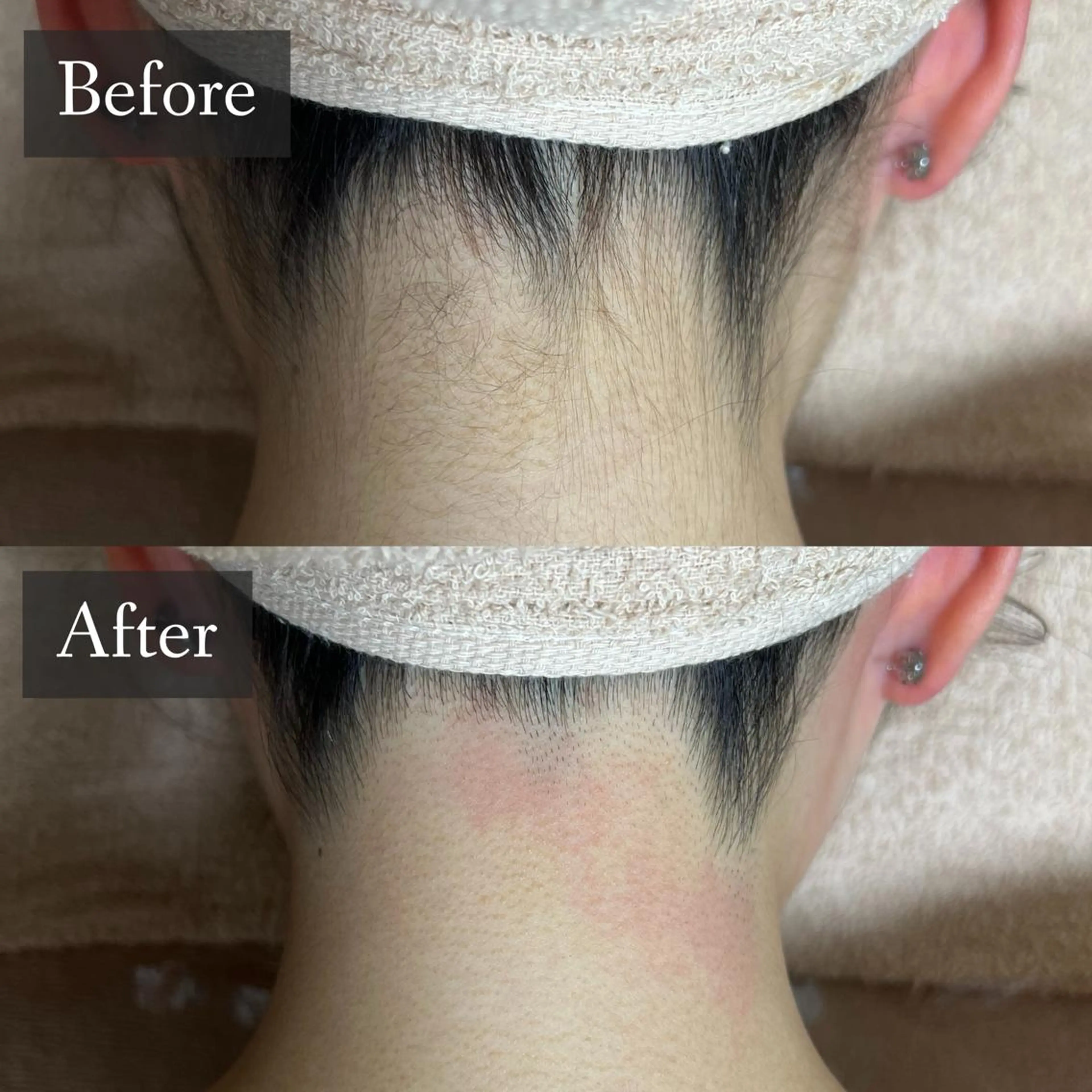 脱毛 脱毛専門サロン BELFINE恵比寿のエステ・リラクイメージ