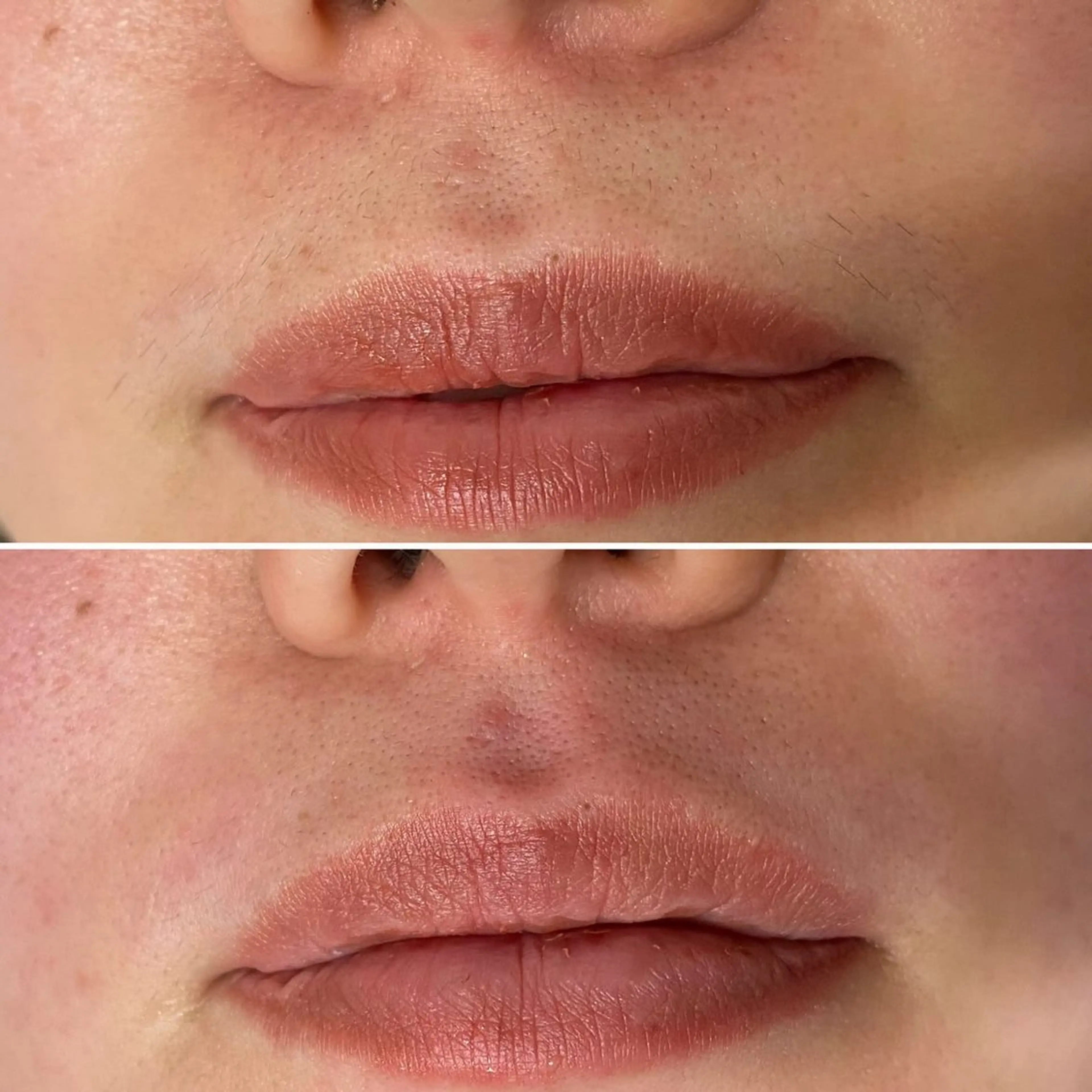 脱毛 padma シュガーリングのエステ・リラクイメージ