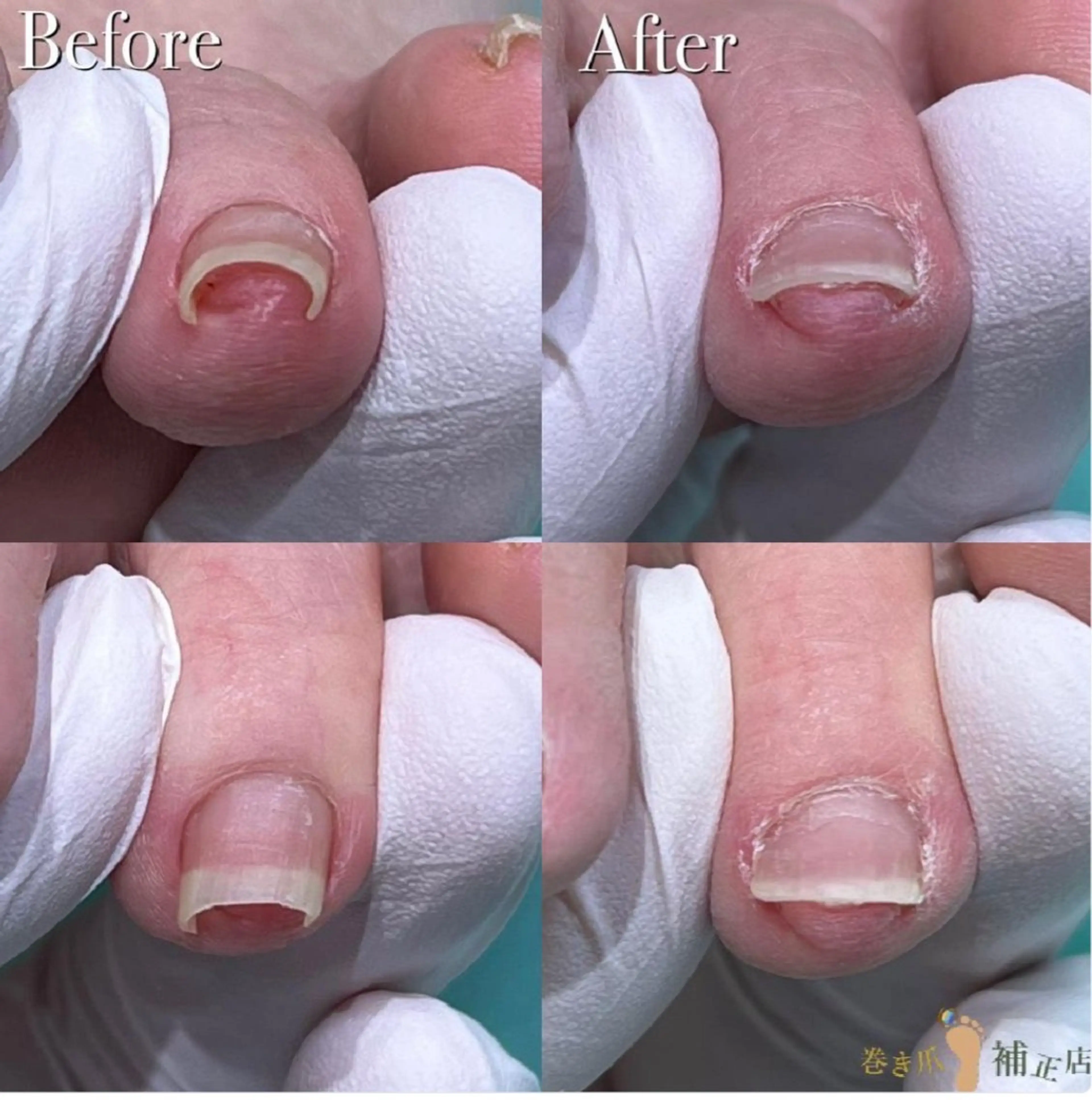 リラク 福岡巻き爪補正店 博多店のエステ・リラクイメージ