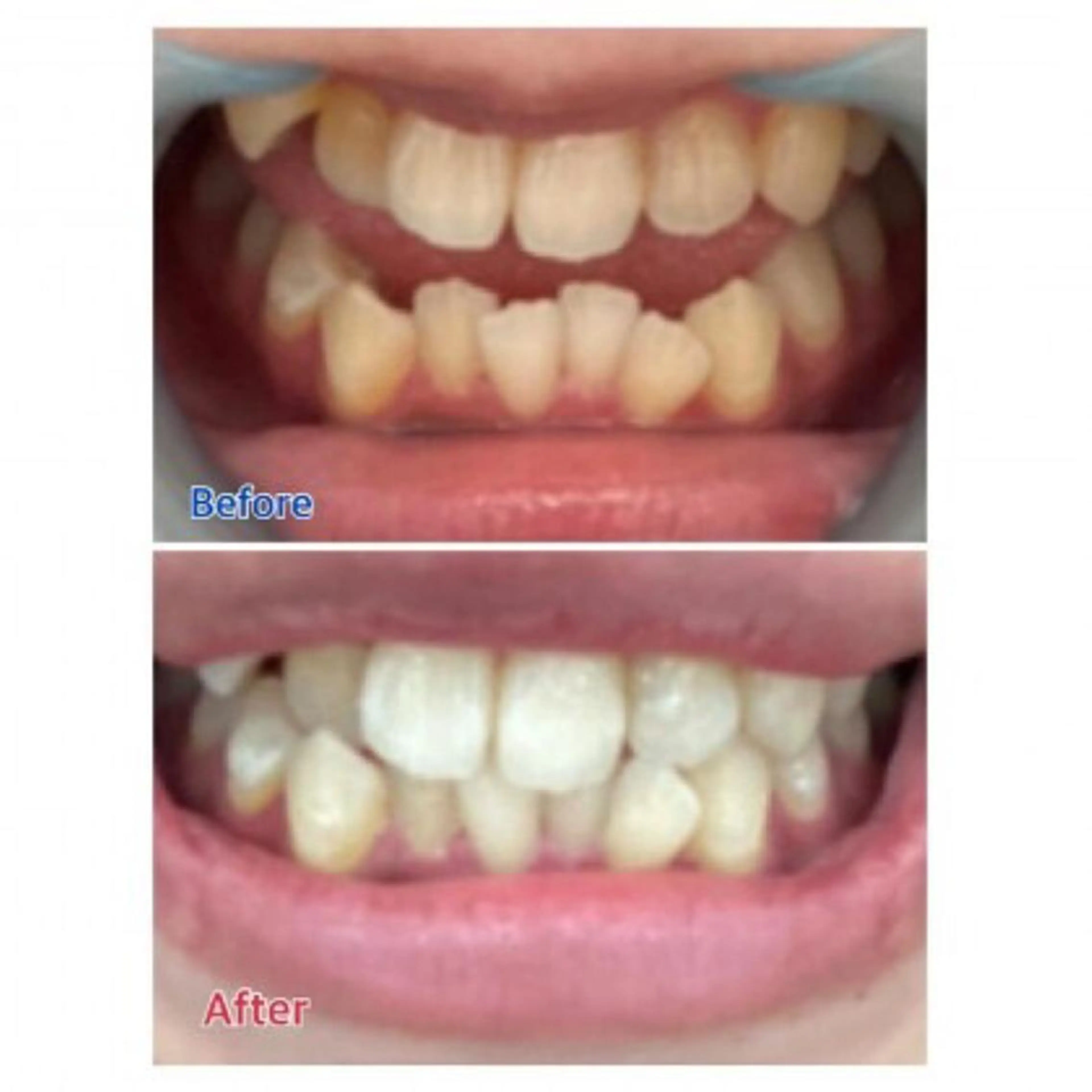 Ｍ渋谷 ホワイトニングのエステ・リラクイメージ