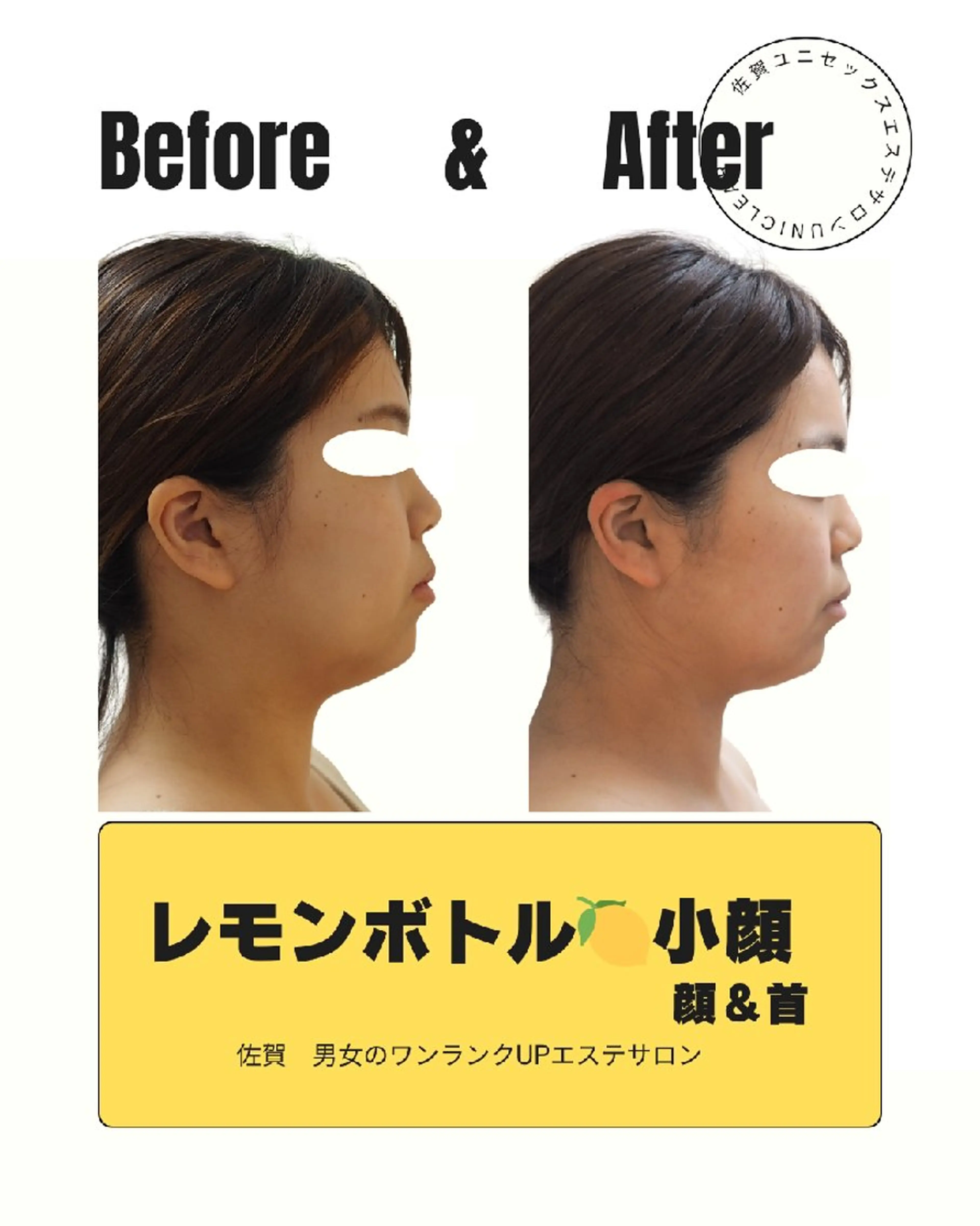 ユニセックスエステサロンUniclear所属・佐賀💎痩身エステ 夏までに痩せる🔥のエステ・リラクイメージ