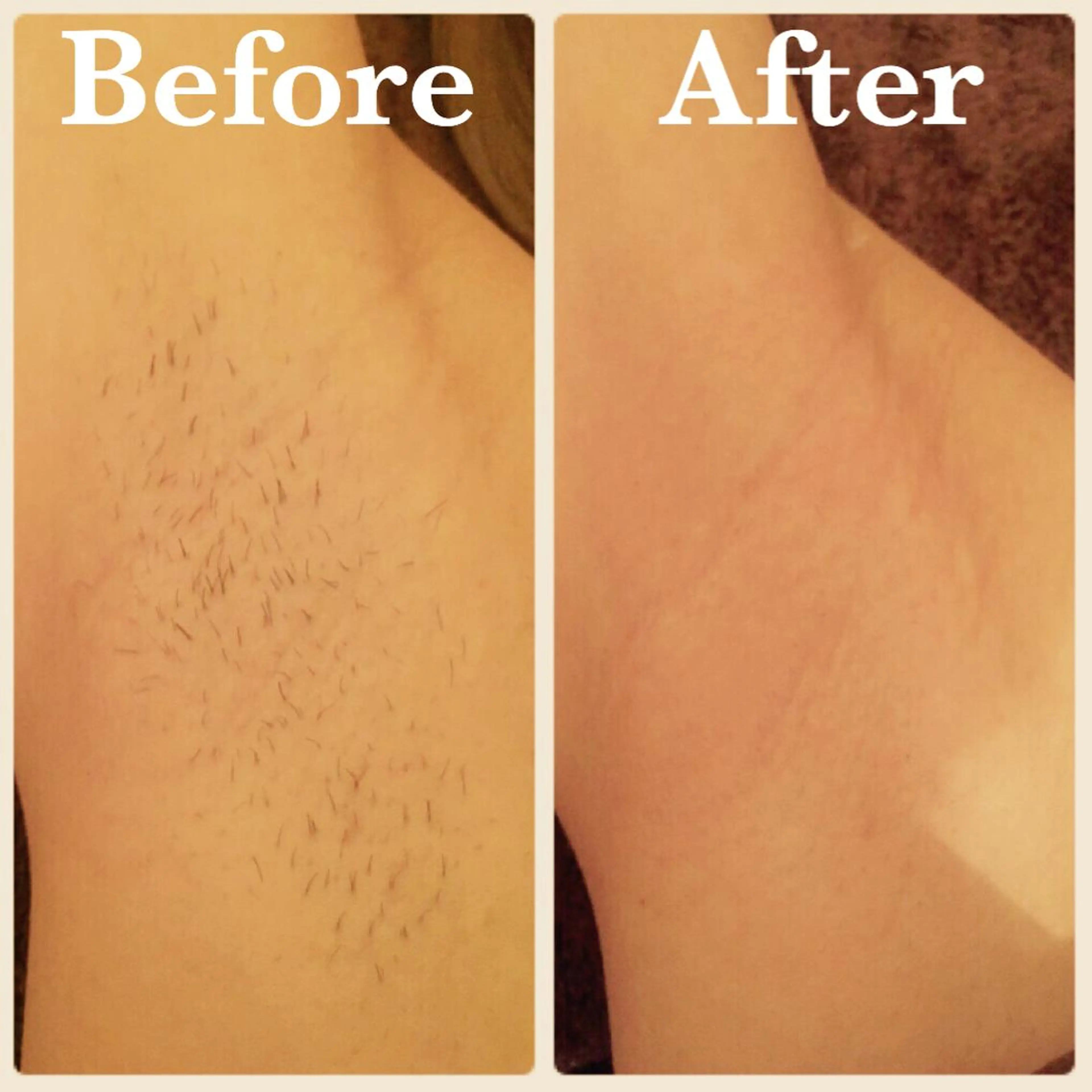 B.GLAM シュガーリング渋谷のエステ・リラクイメージ