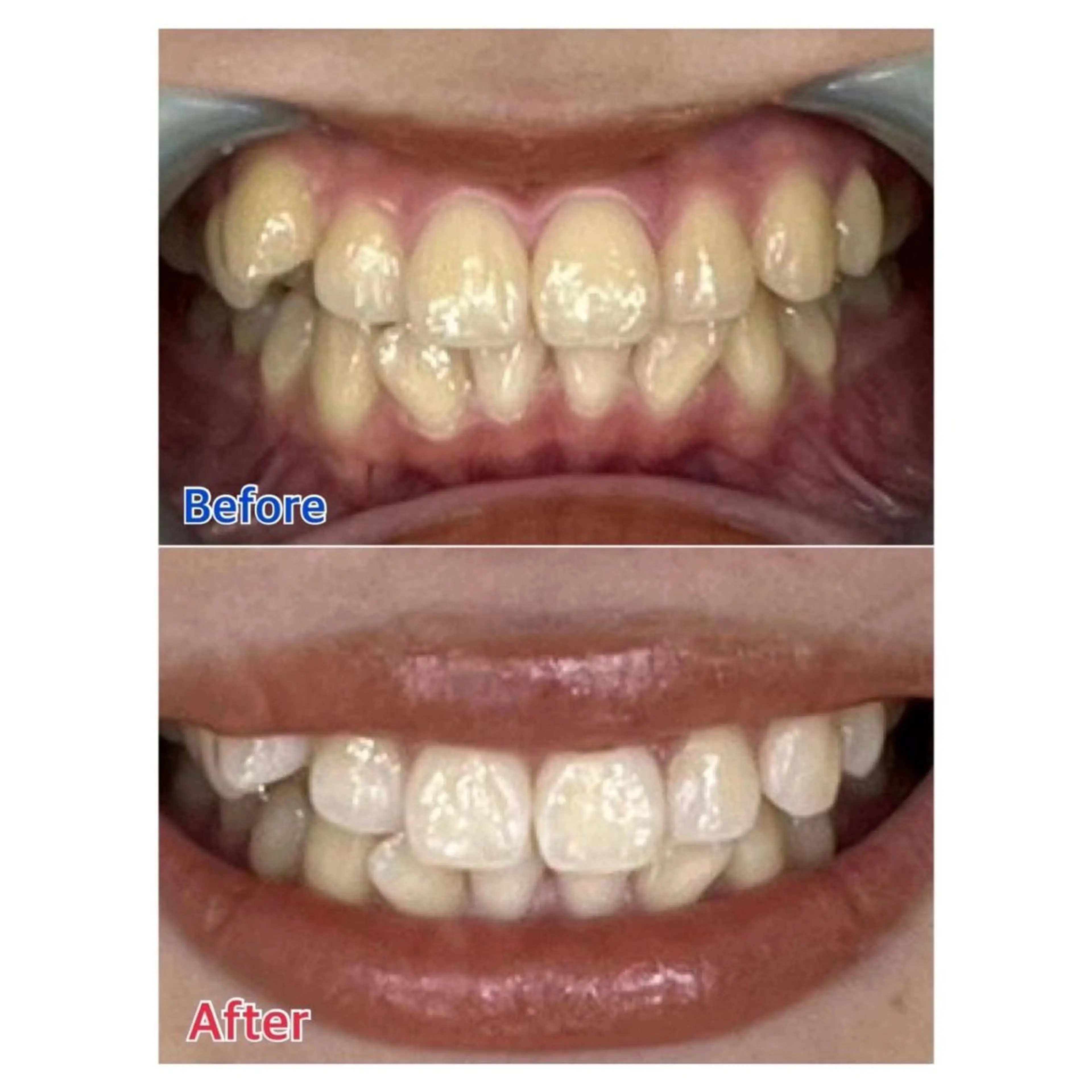 Melty 輝のその他イメージ