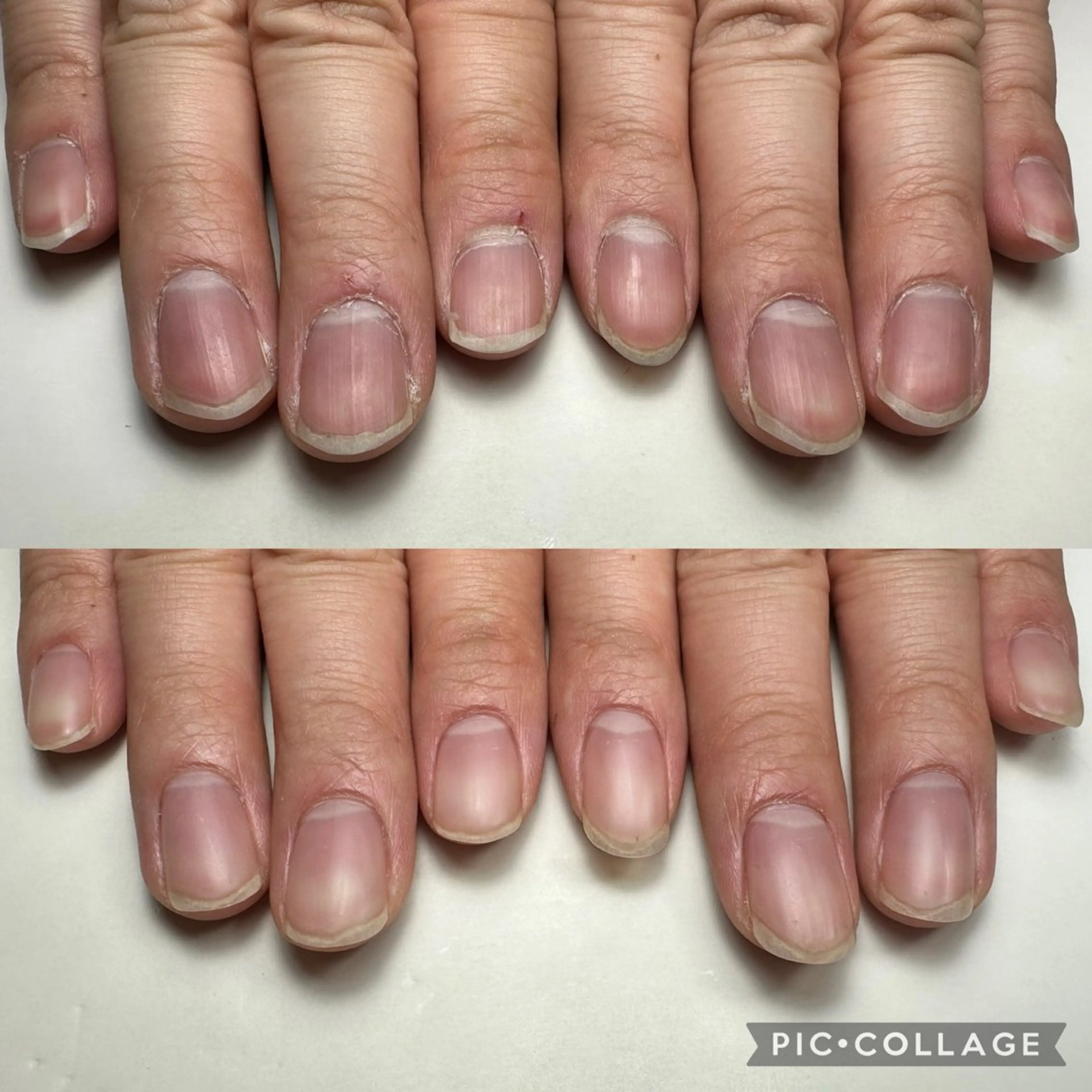 自爪育成(カウンセリング付き)自爪風の写真