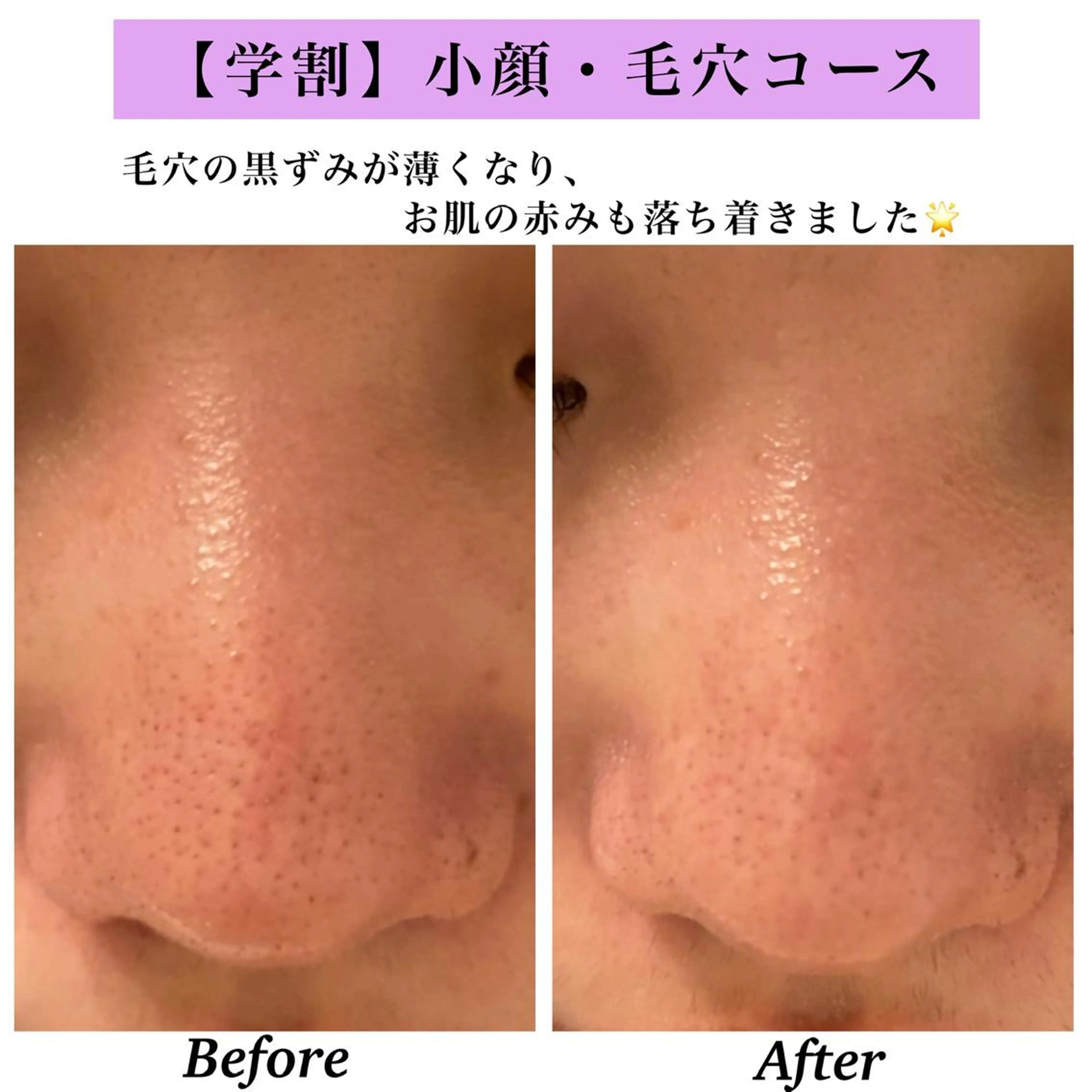 Bellesthe （ベルエステ）のエステ・リラクイメージ