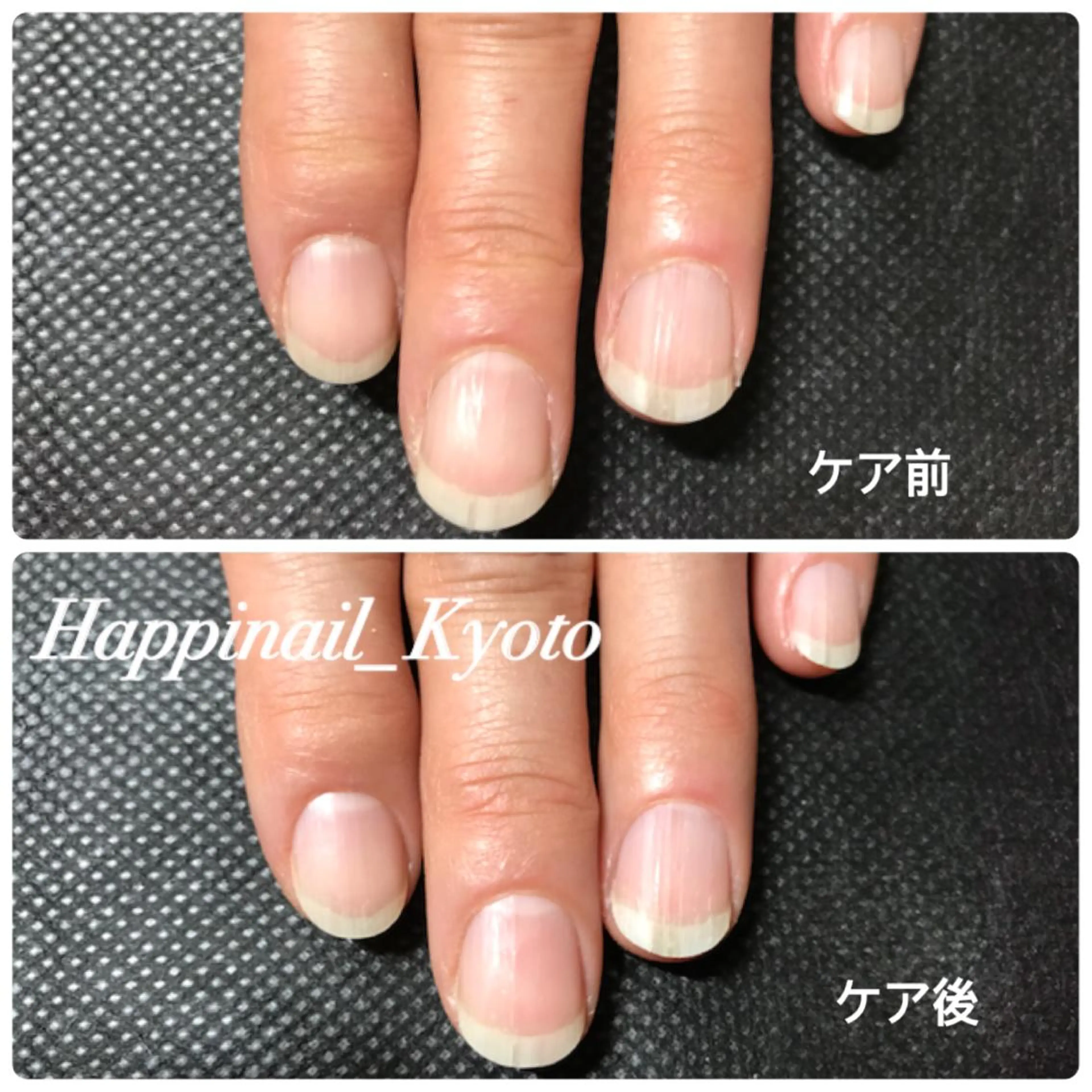 ネイル ケアが得意なサロン Happinailのエステ・リラクイメージ
