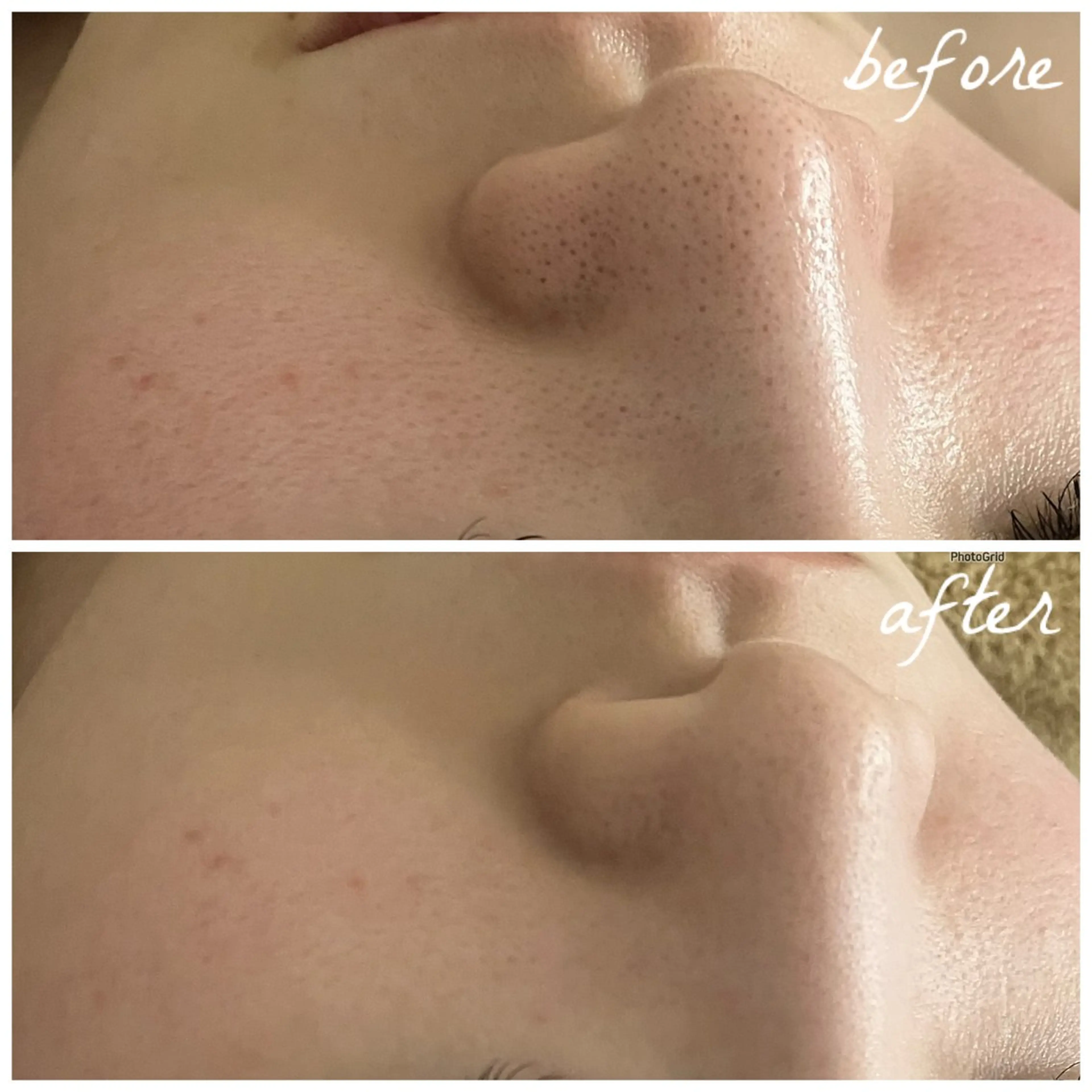 メンズ エステ メナード岐阜市茜部 杉浦のエステ・リラクイメージ