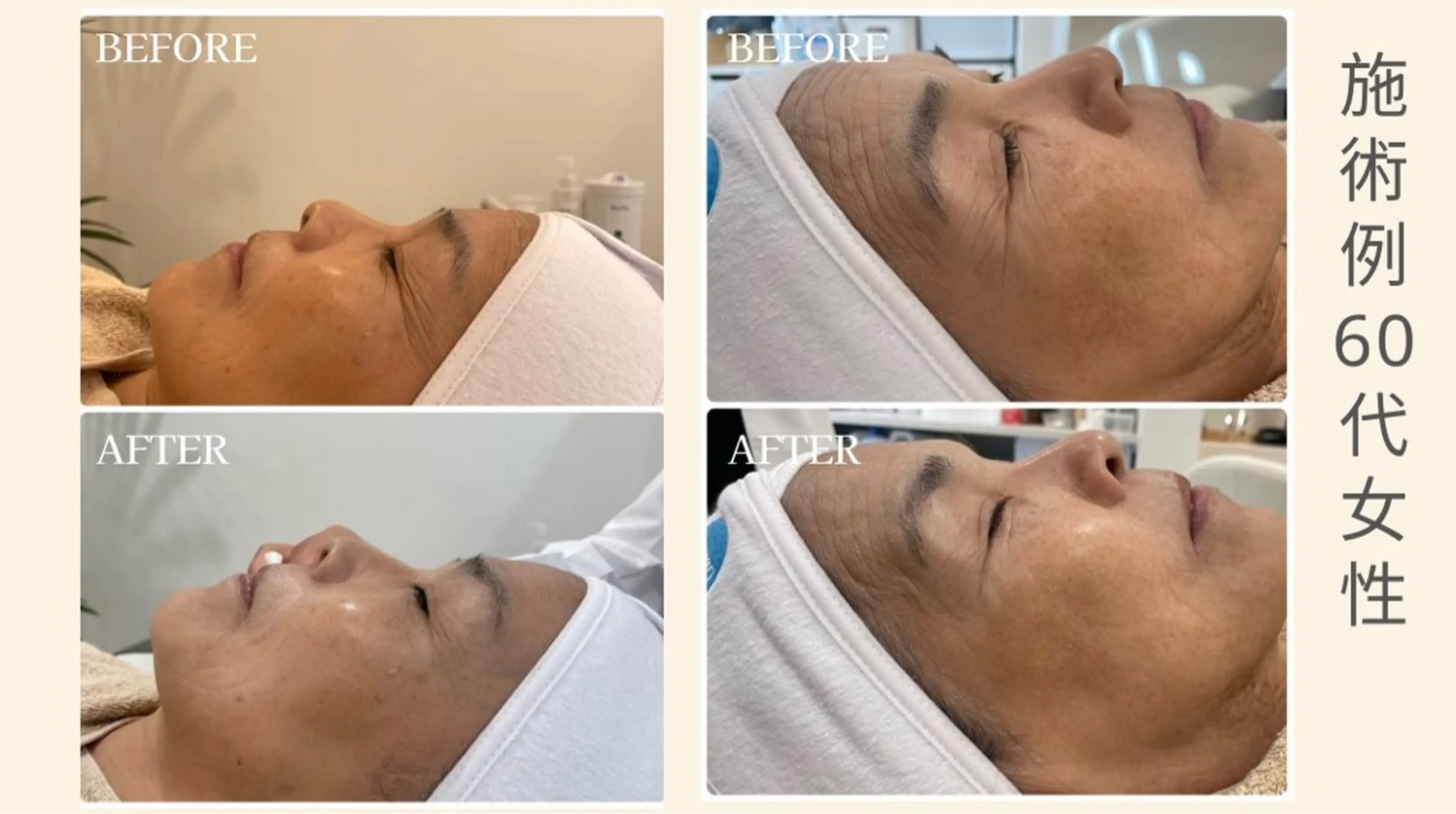 ゾンビマスク 単品の写真