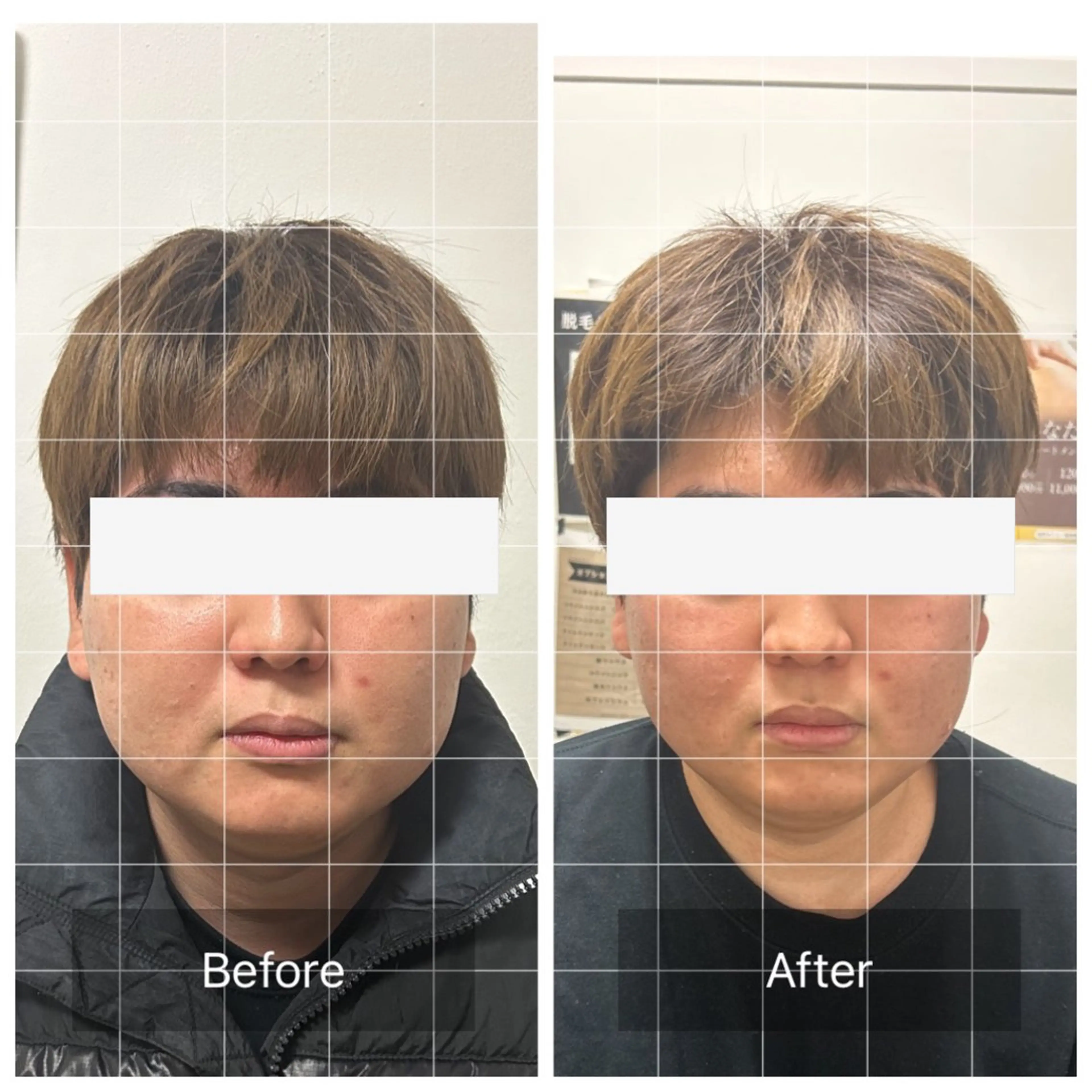 メンズ 学生（メンズ向け） エマニエル USAのエステ・リラクイメージ