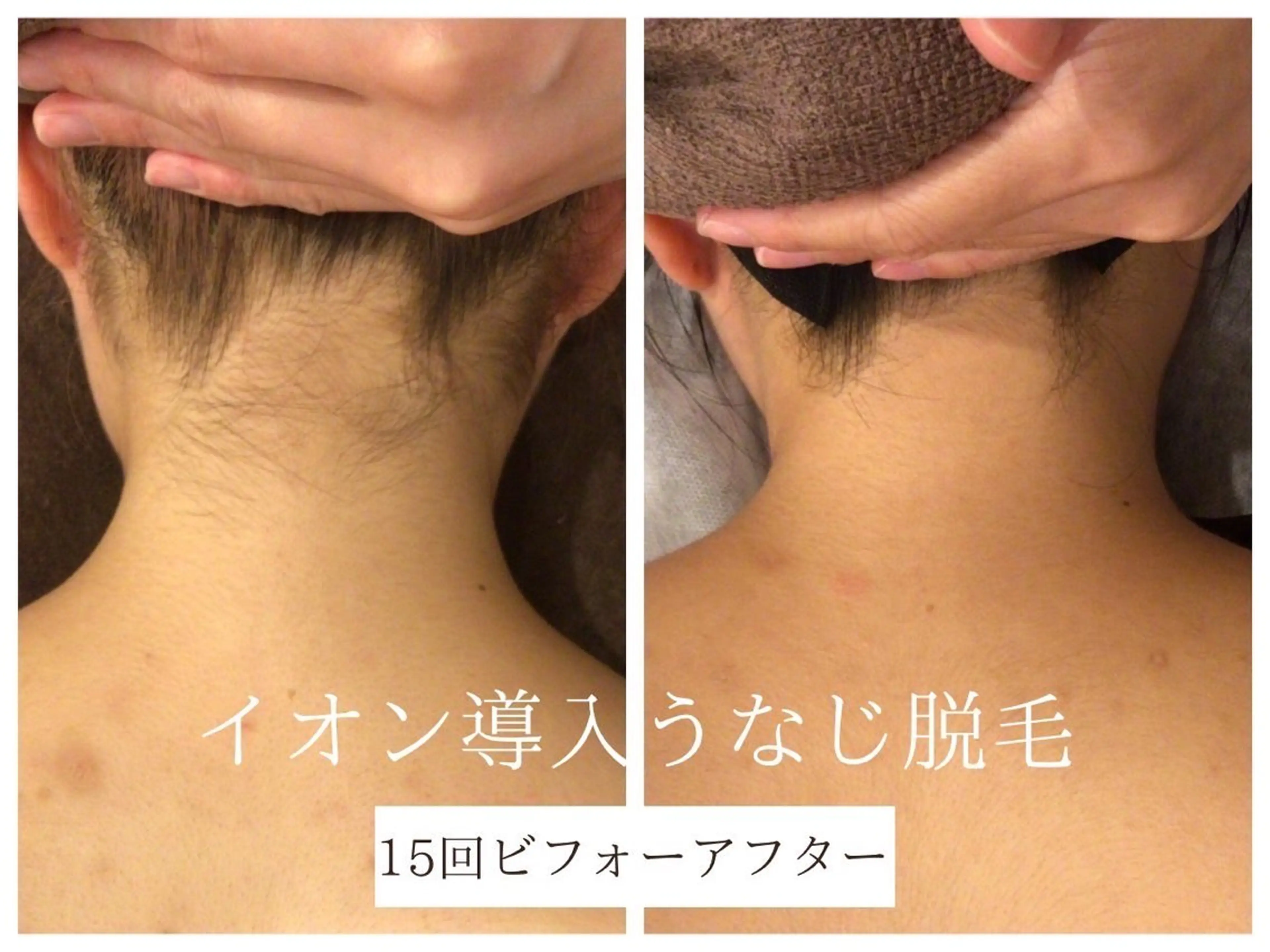 脱毛 🎀うなじ脱毛🎀 ㅣLino堀江のエステ・リラクイメージ