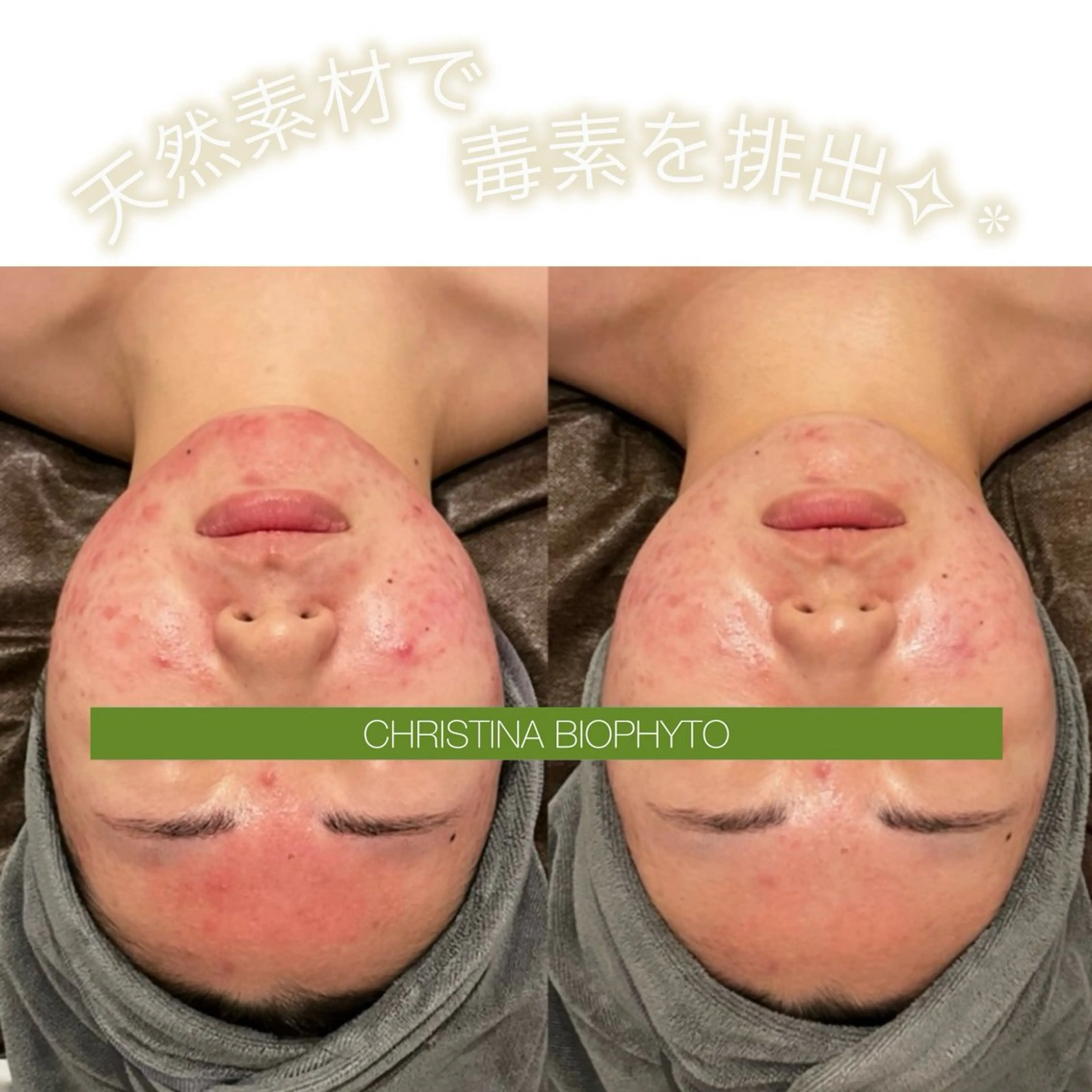 小顔コルギ ☆表参道/外苑前のエステ・リラクイメージ