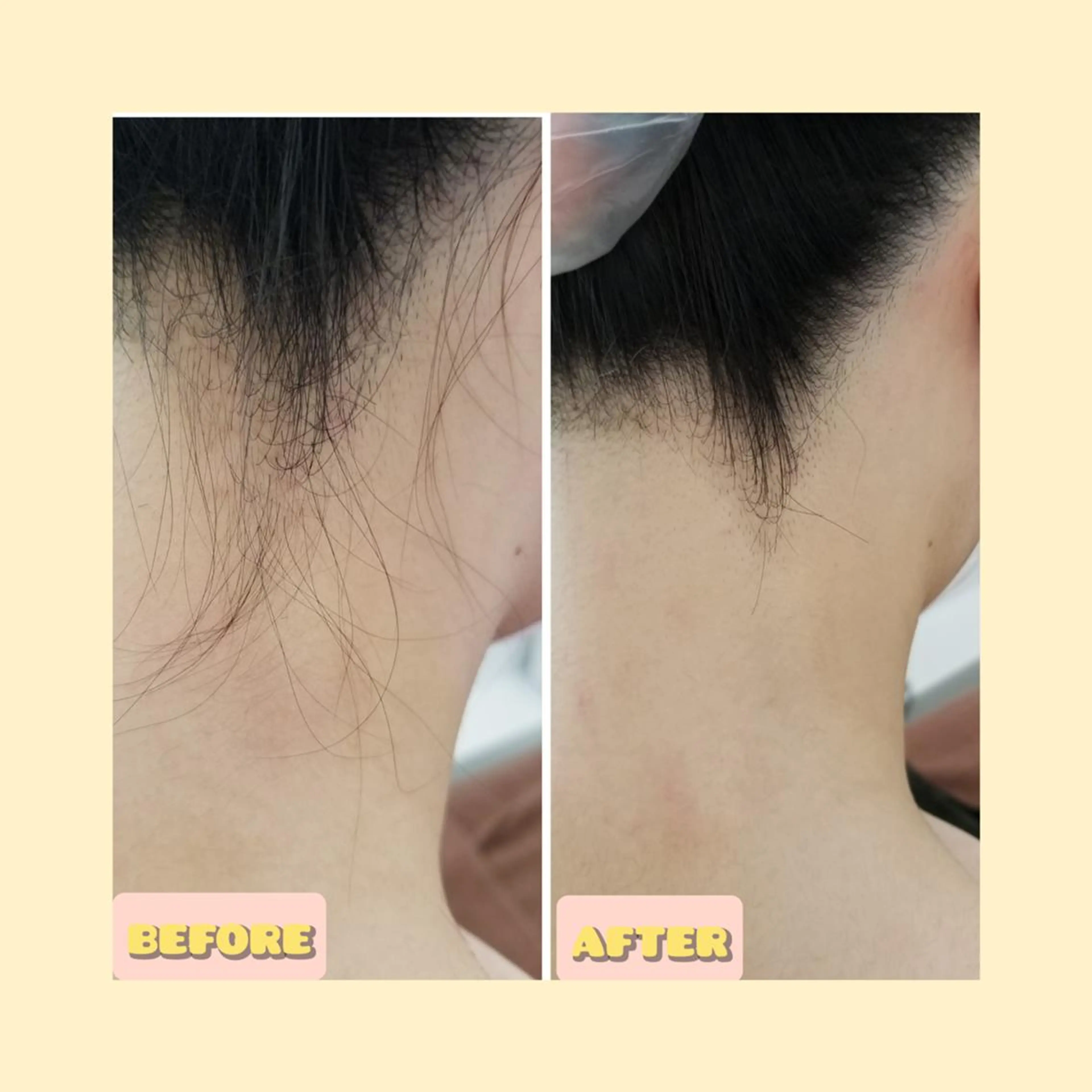 脱毛 salonde ReGodのエステ・リラクイメージ