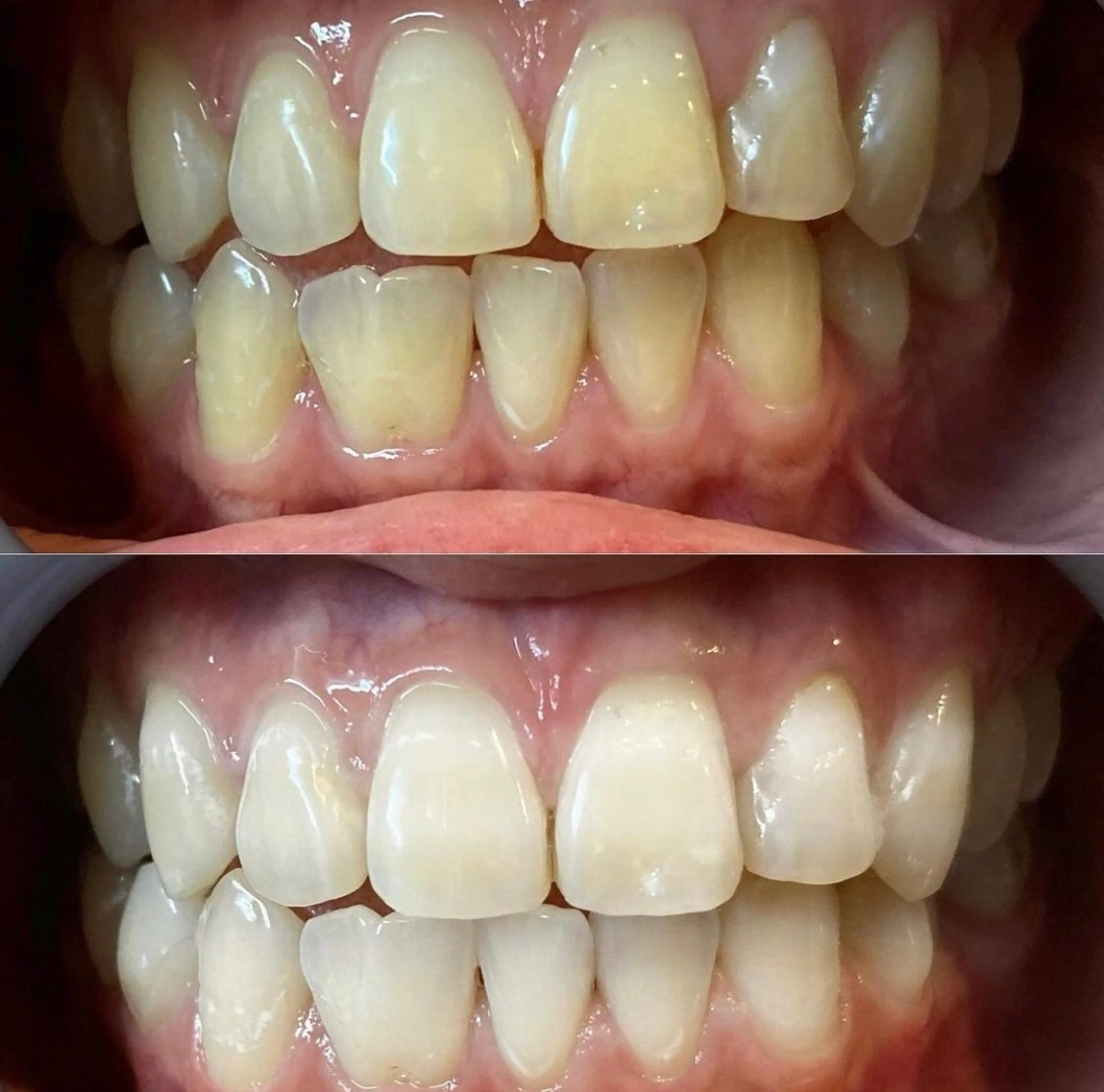 エステ リラク LBSホワイトニング上野店所属・LBSホワイトニング 🌐 上野店公式のエステ・リラクイメージ