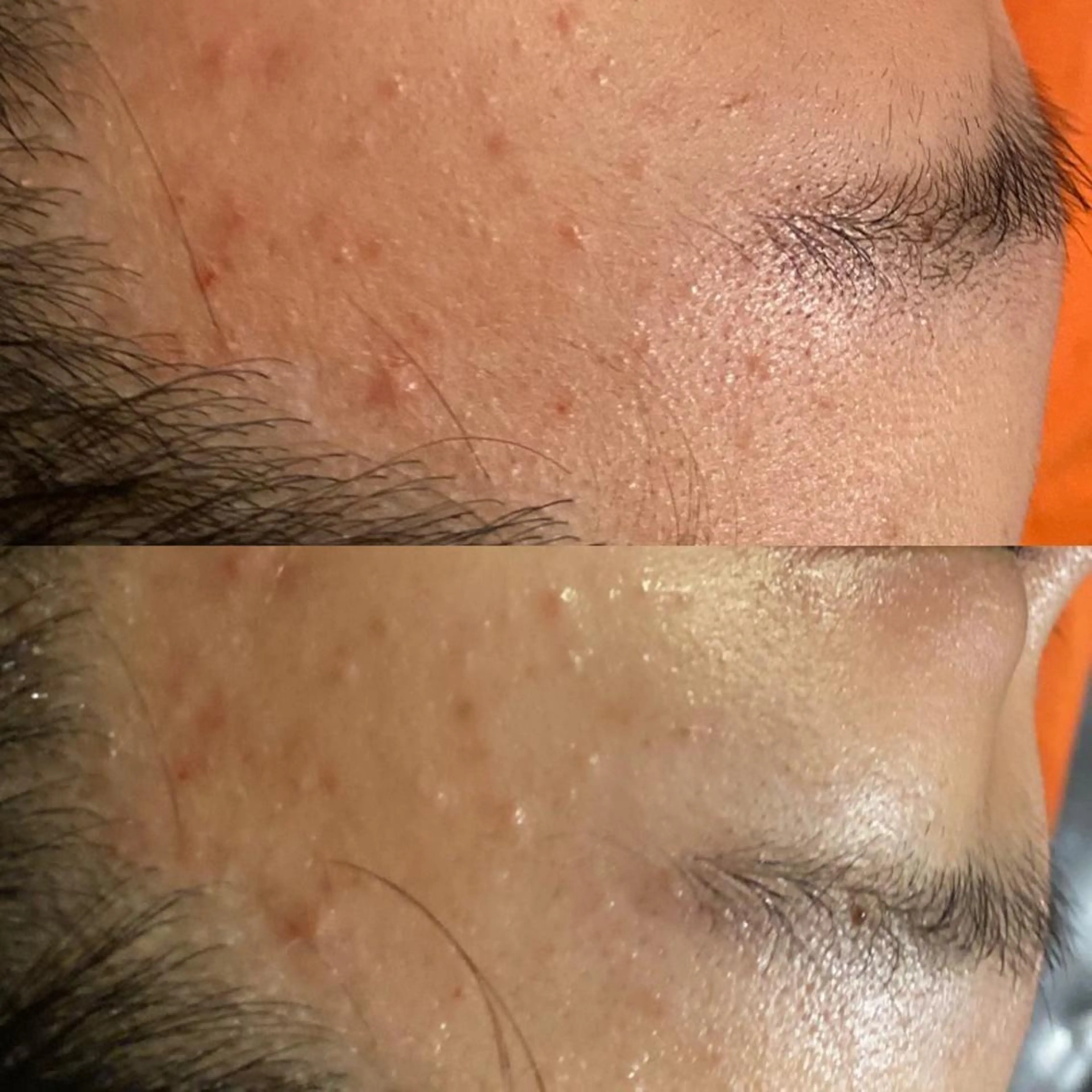 毛穴から始める肌メン テマンダリンオレンジのエステ・リラクイメージ