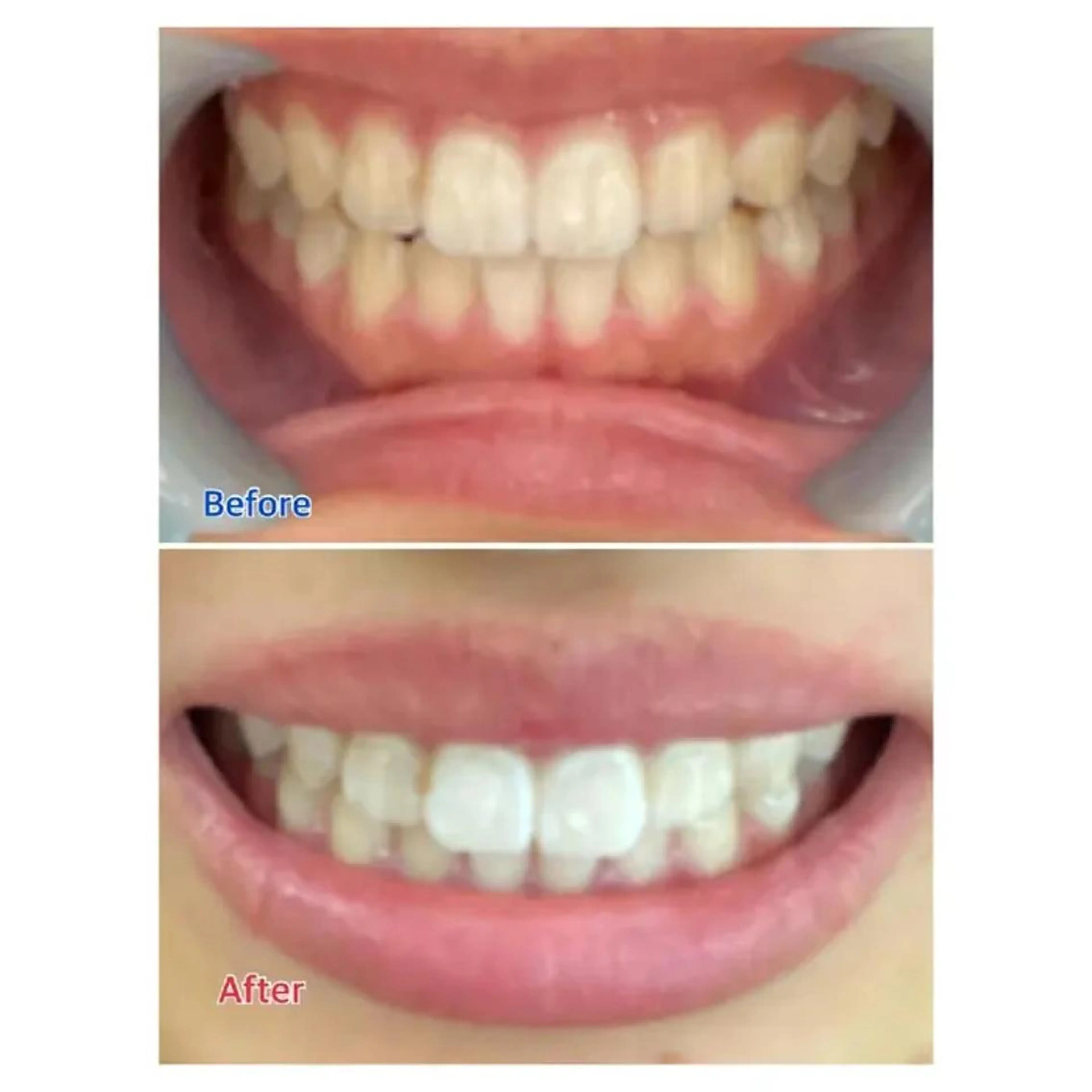 M渋谷 ホワイトニングのその他イメージ