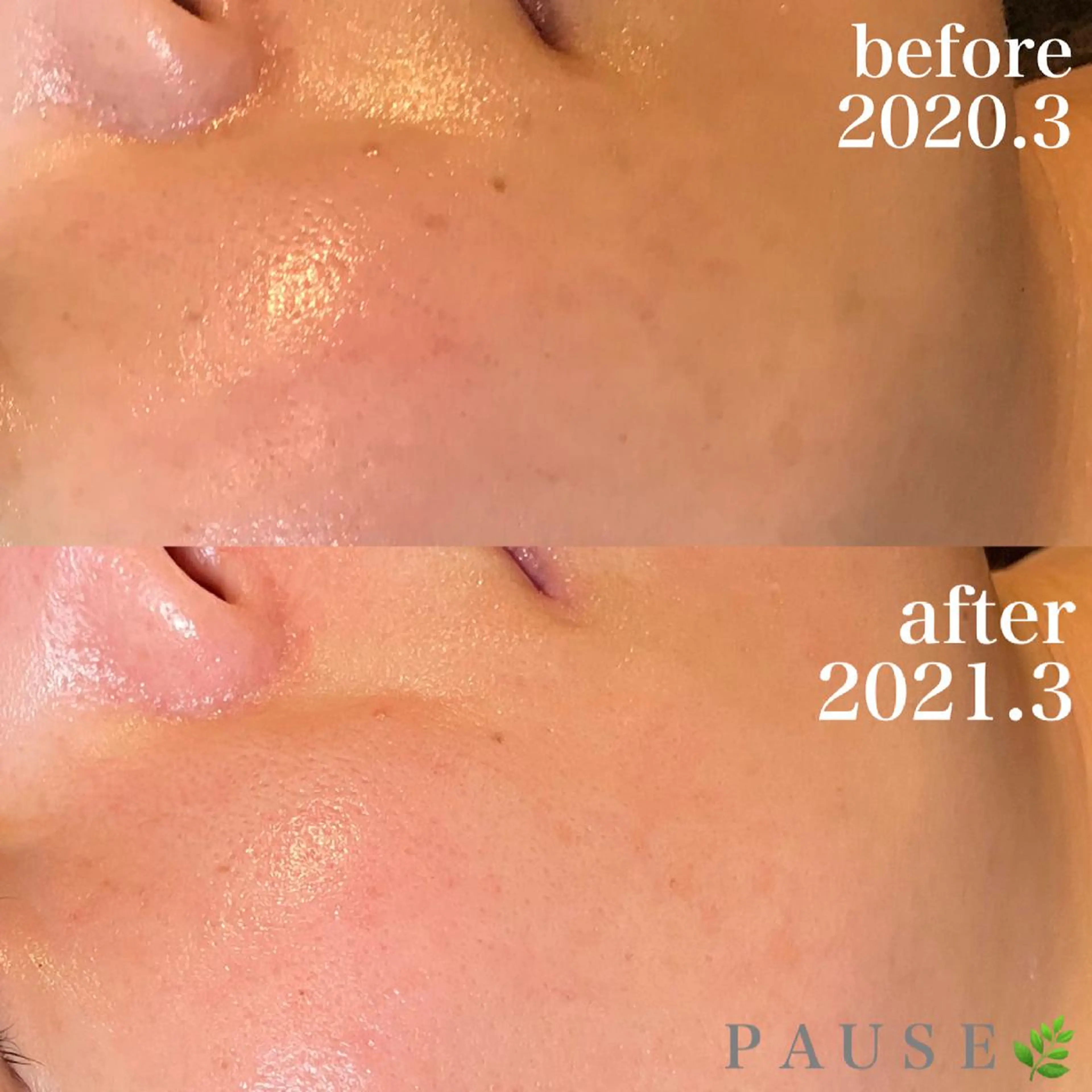 エステ 浜野 恵美のエステ・リラクイメージ