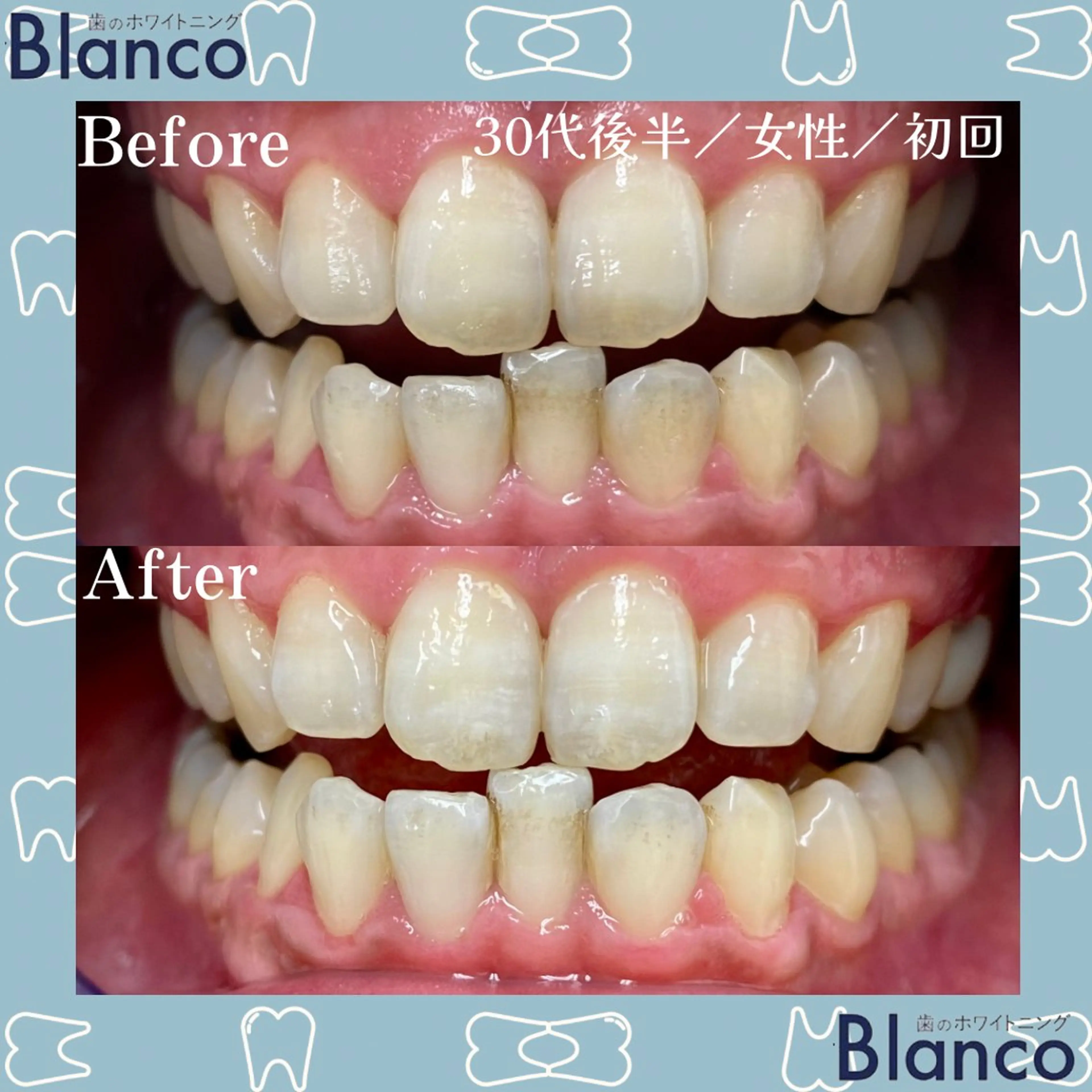 Blanco 川口駅前店のその他イメージ