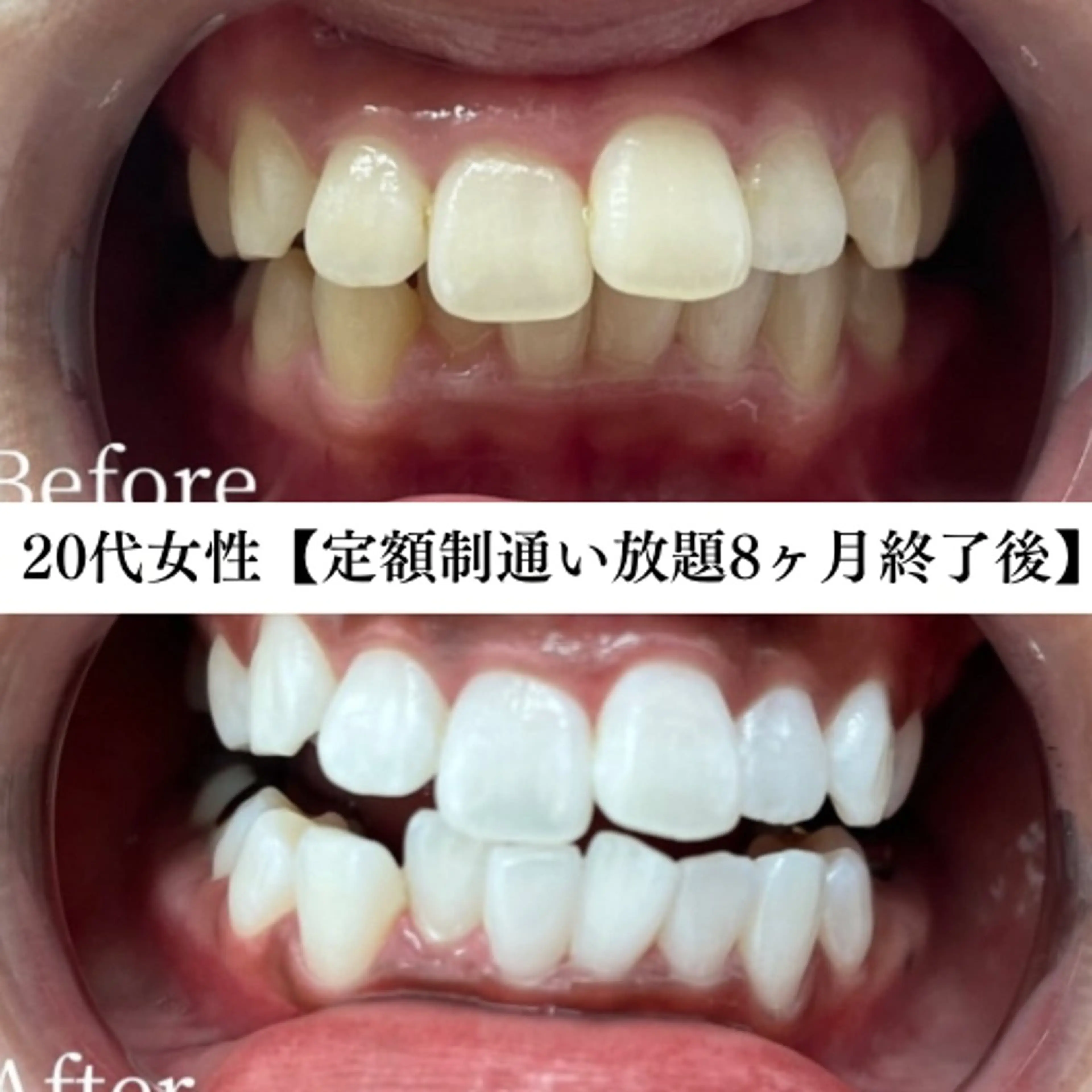 メンズ キッズ エステ リラク セルフホワイトニング WHITE福岡天神店のエステ・リラクイメージ