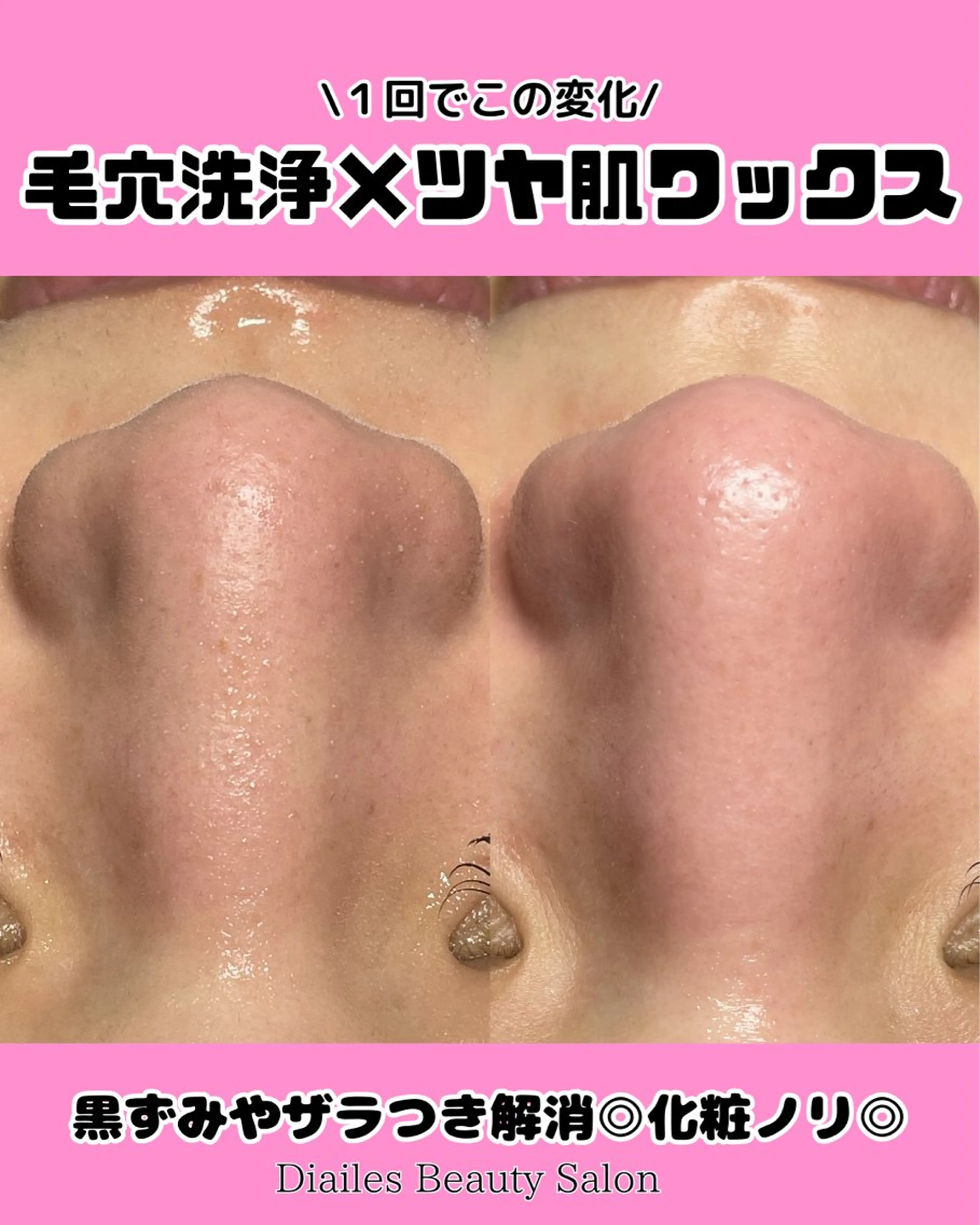 エステ Diailes 💎ななのエステ・リラクイメージ