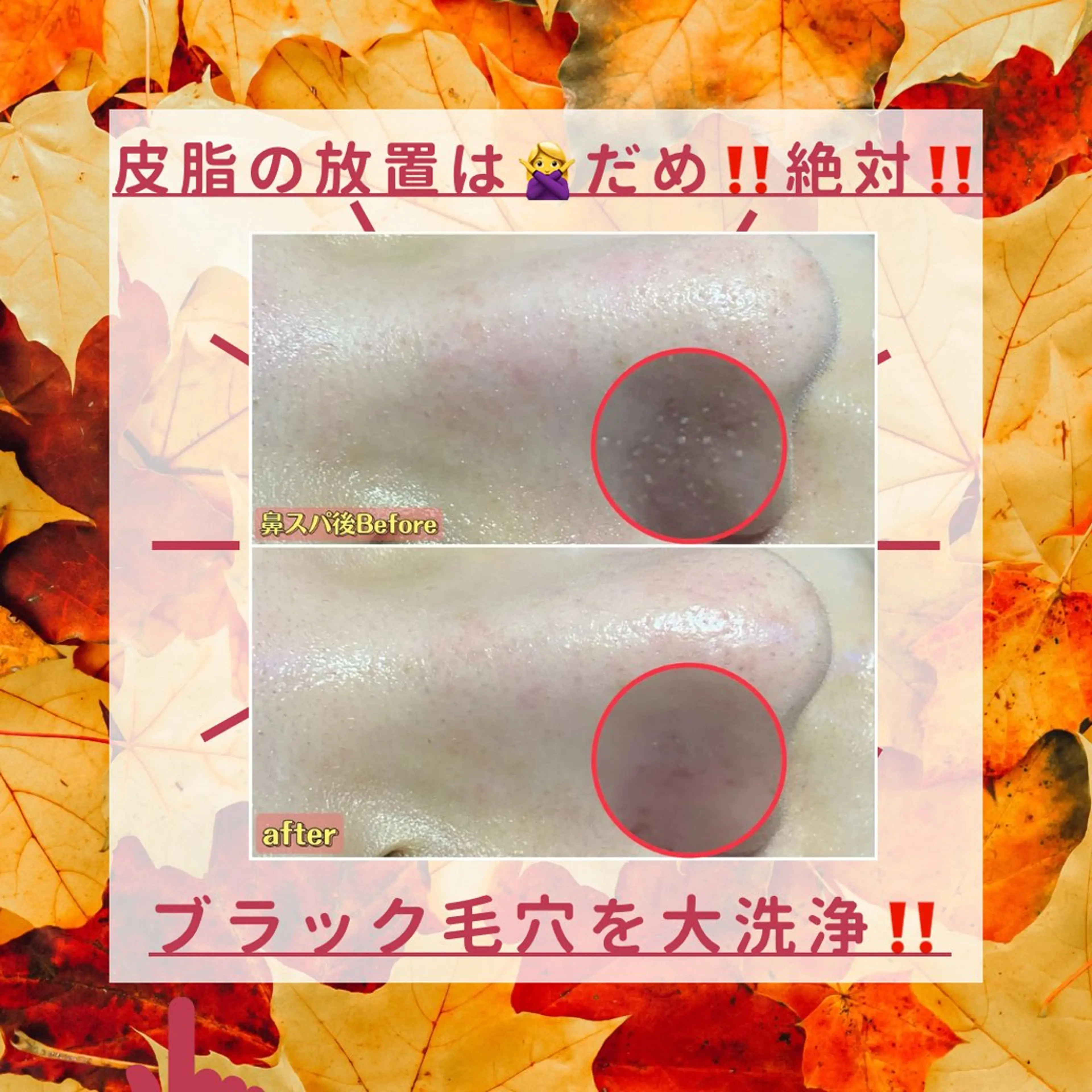 エステ 毛穴フェイシャル エステ専門店BBのエステ・リラクイメージ