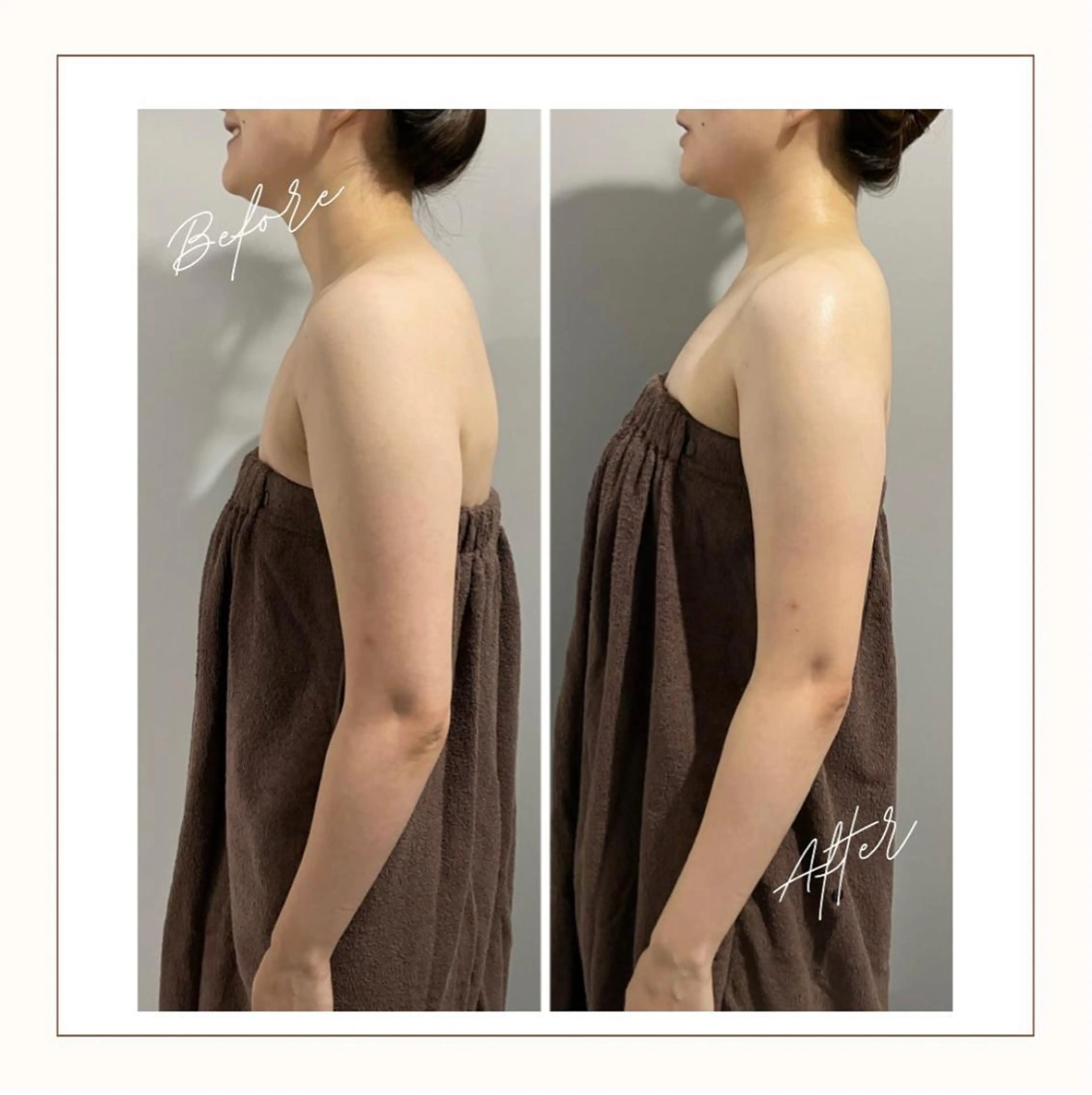 ENCHANT 脱毛.小顔.毛穴のエステ・リラクイメージ