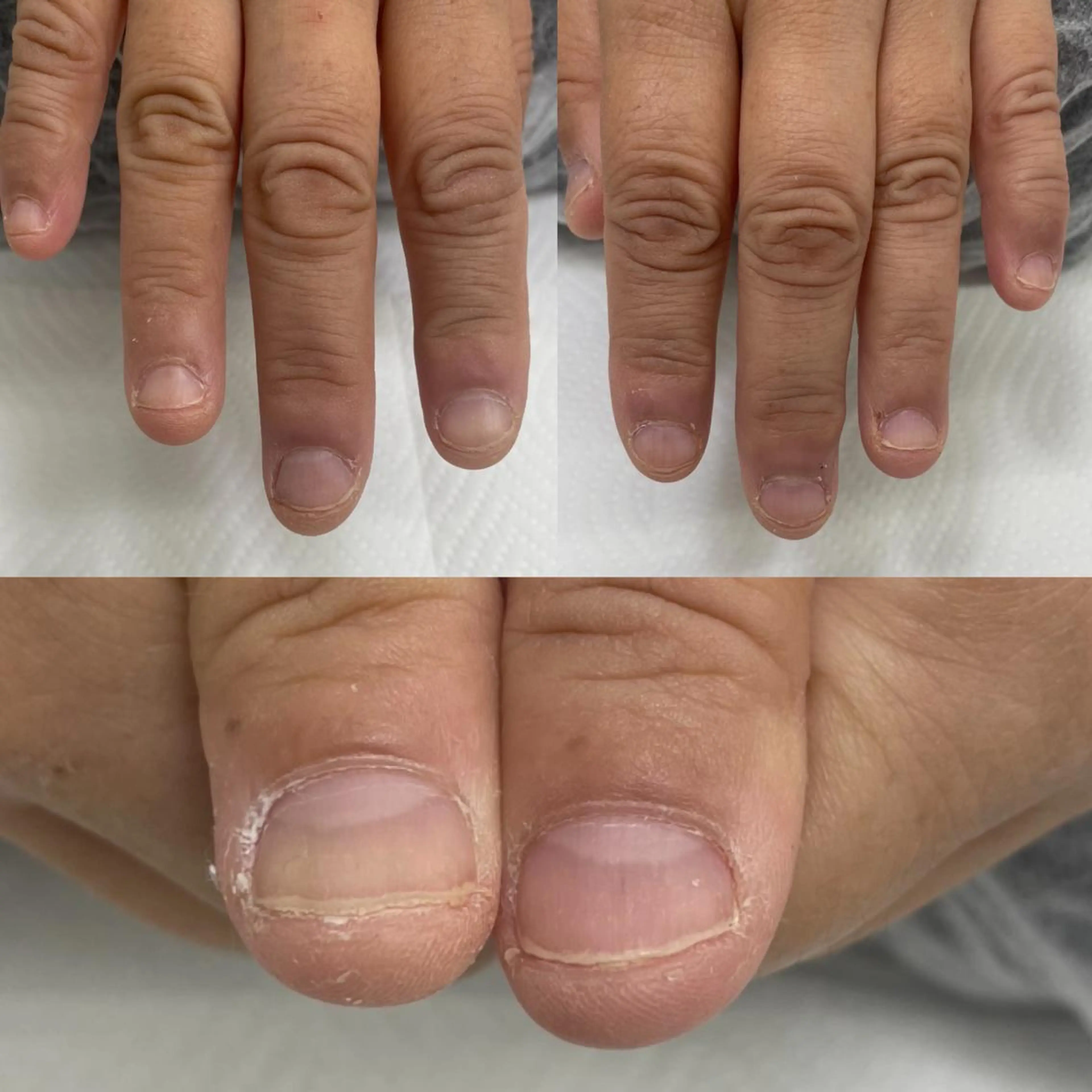 【深爪さん限定】長さ出し+ハンドジェルネイルモニター様 ワンカラーorグラデーションorラメグラの写真