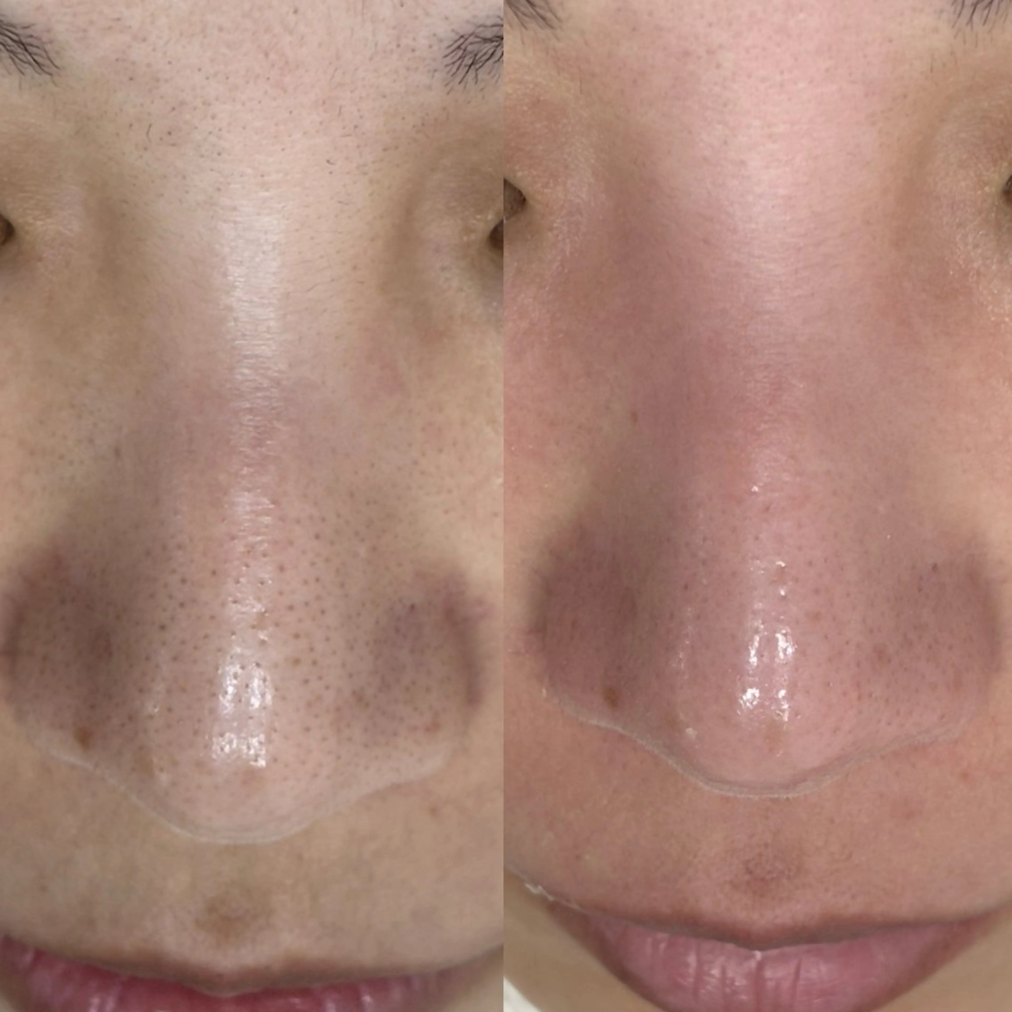 毛穴に特化したサロン MYFAIRLADYのエステ・リラクイメージ