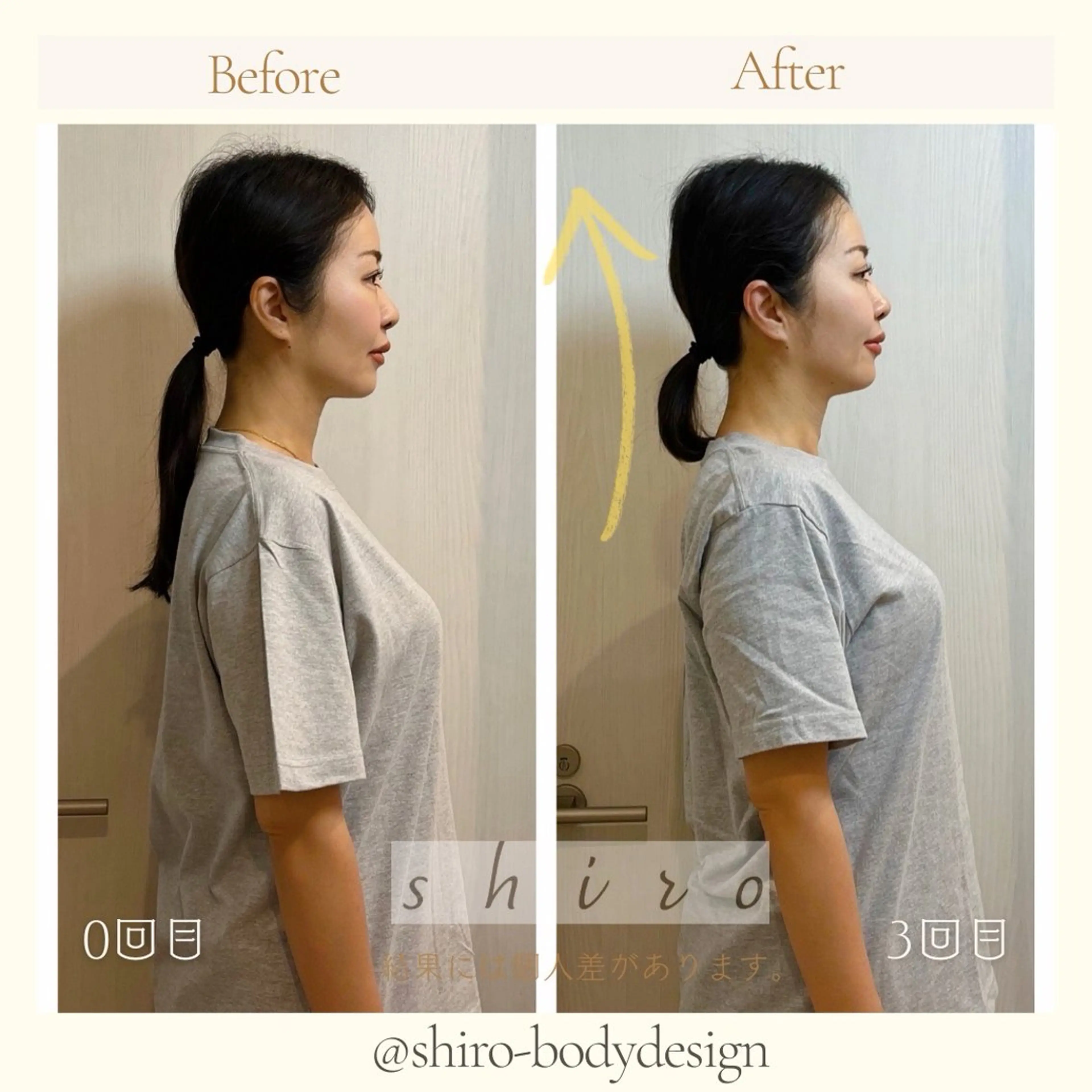 小顔矯正勝山式 shiroしろのエステ・リラクイメージ