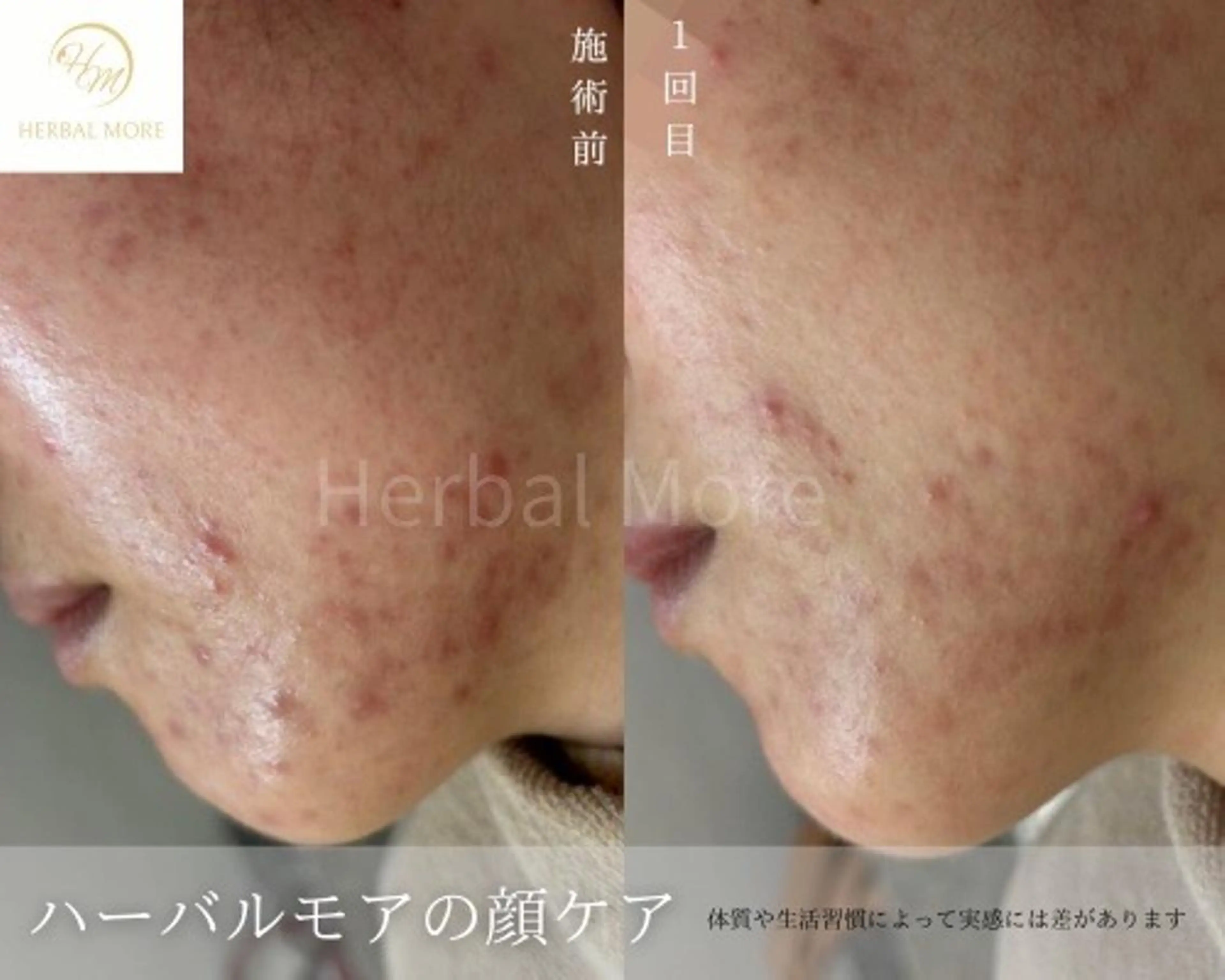 脱毛・眉毛・フェイス サロンN久留米店の眉毛・アイブロウイメージ