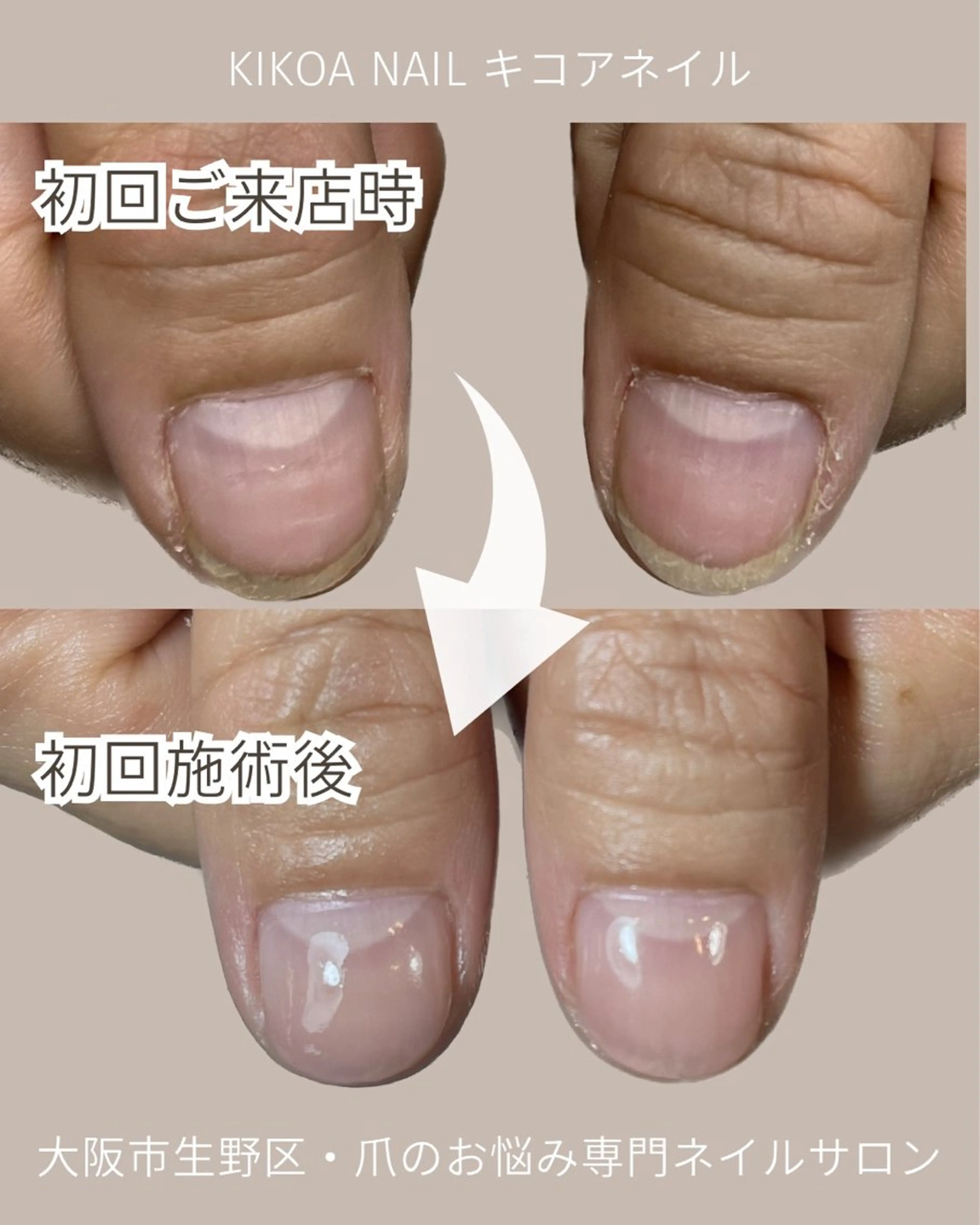ネイル KIKOA NAIL キコアネイルのネイルデザイン