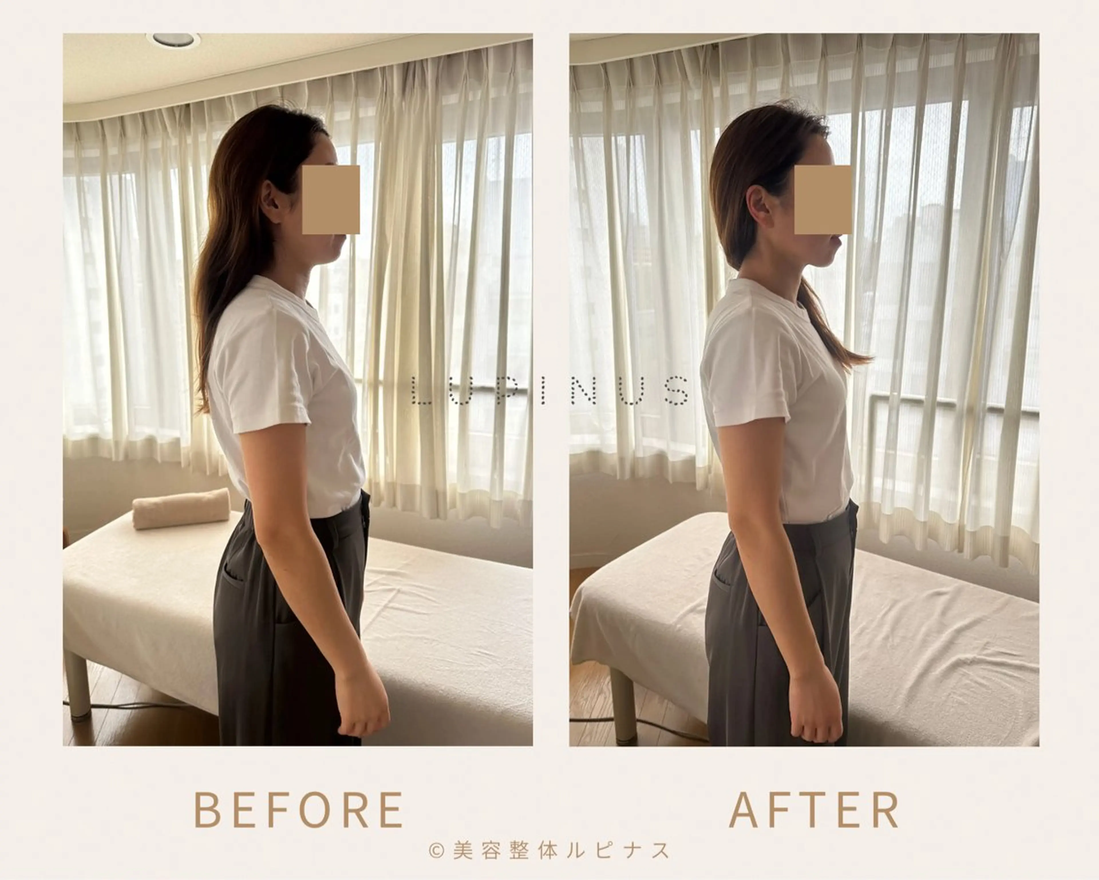 【広尾】むくみ・巻き肩調整｜小顔ケア✖️姿勢バランス調整(症例モニター募集)の写真