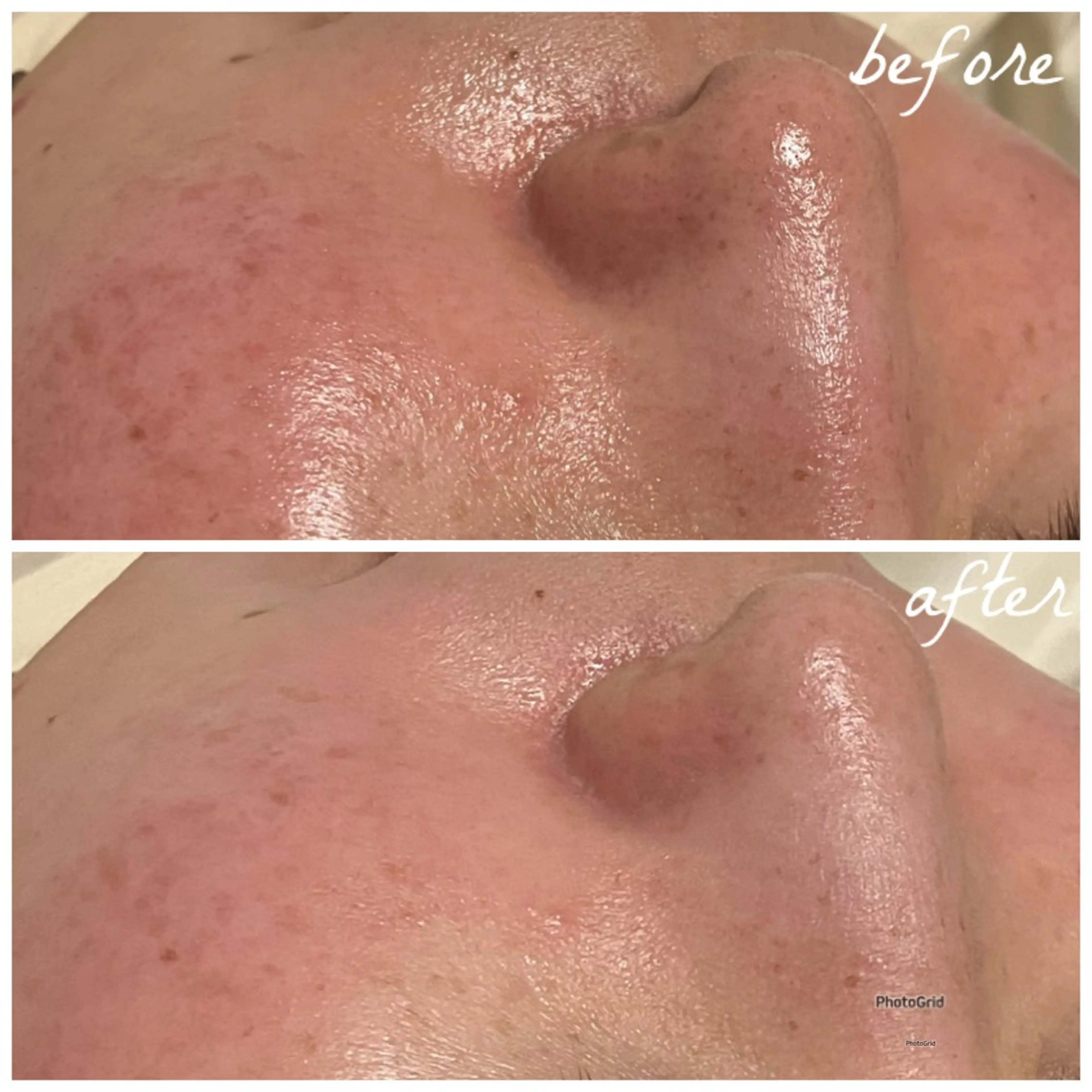 メンズ エステ メナード岐阜茜部 杉浦のエステ・リラクイメージ