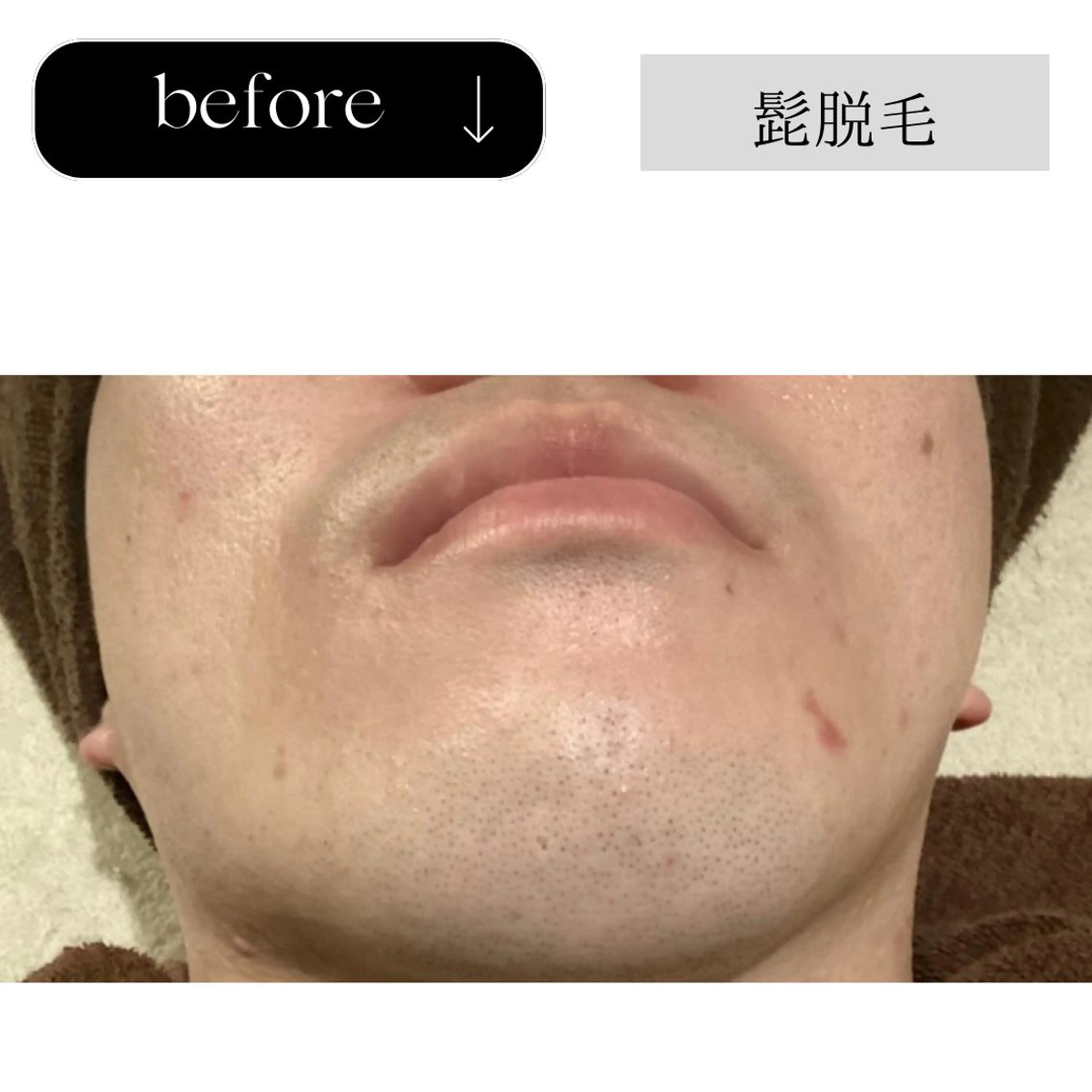 脱毛 beauty CHOOSEのエステ・リラクイメージ