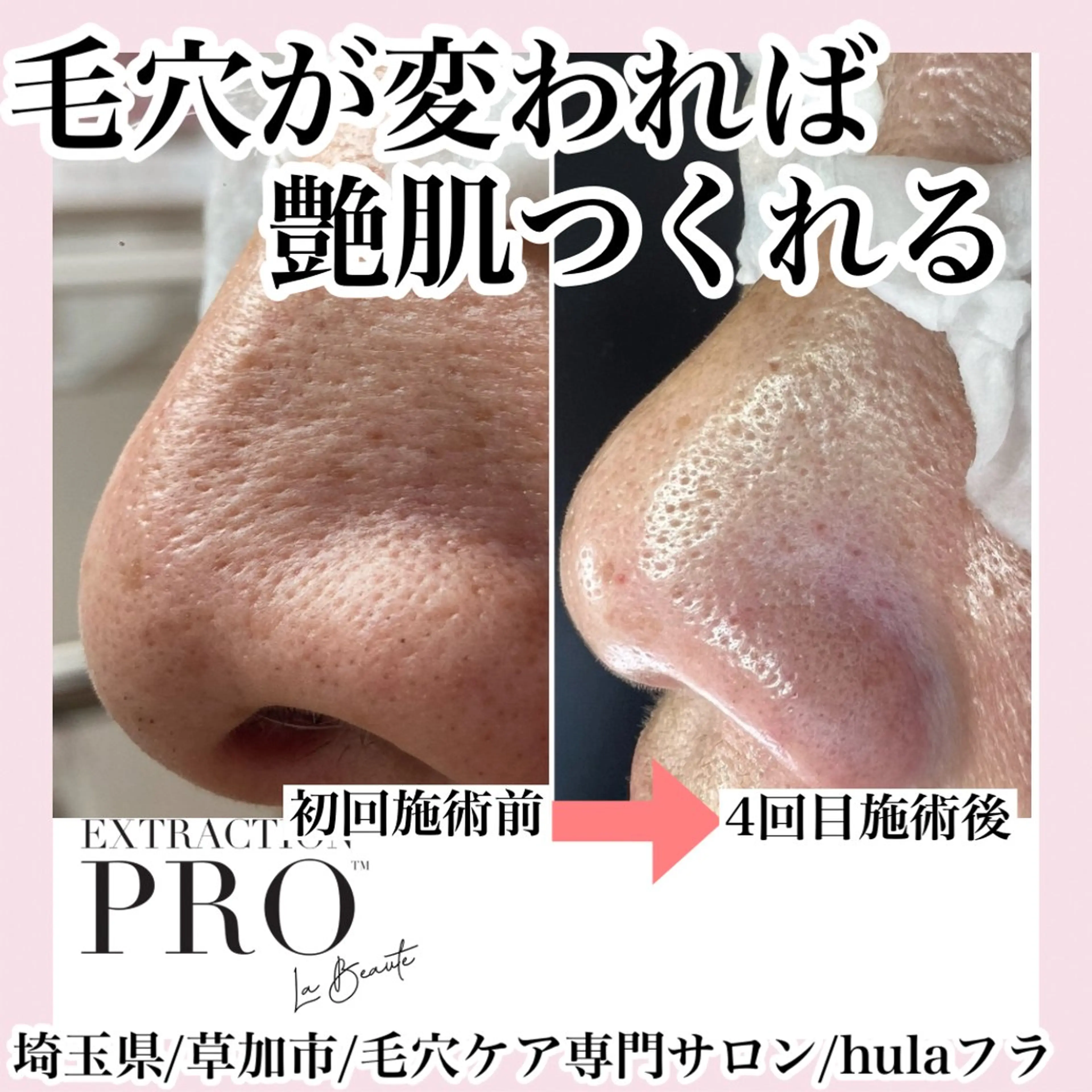 アイブロウ エステ 毛穴専門店hula 杉山智美のエステ・リラクイメージ