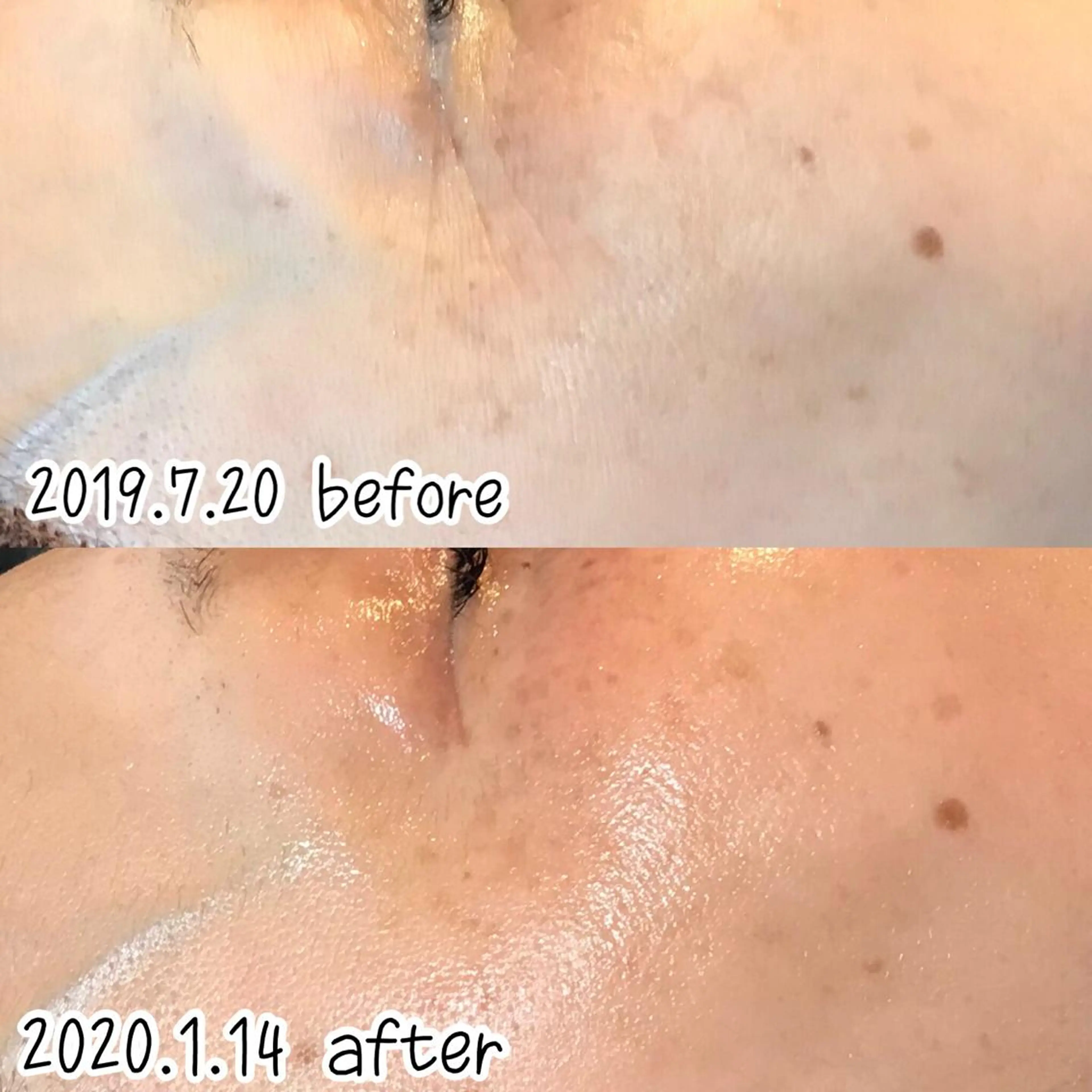 エステ 浜野 恵美のエステ・リラクイメージ