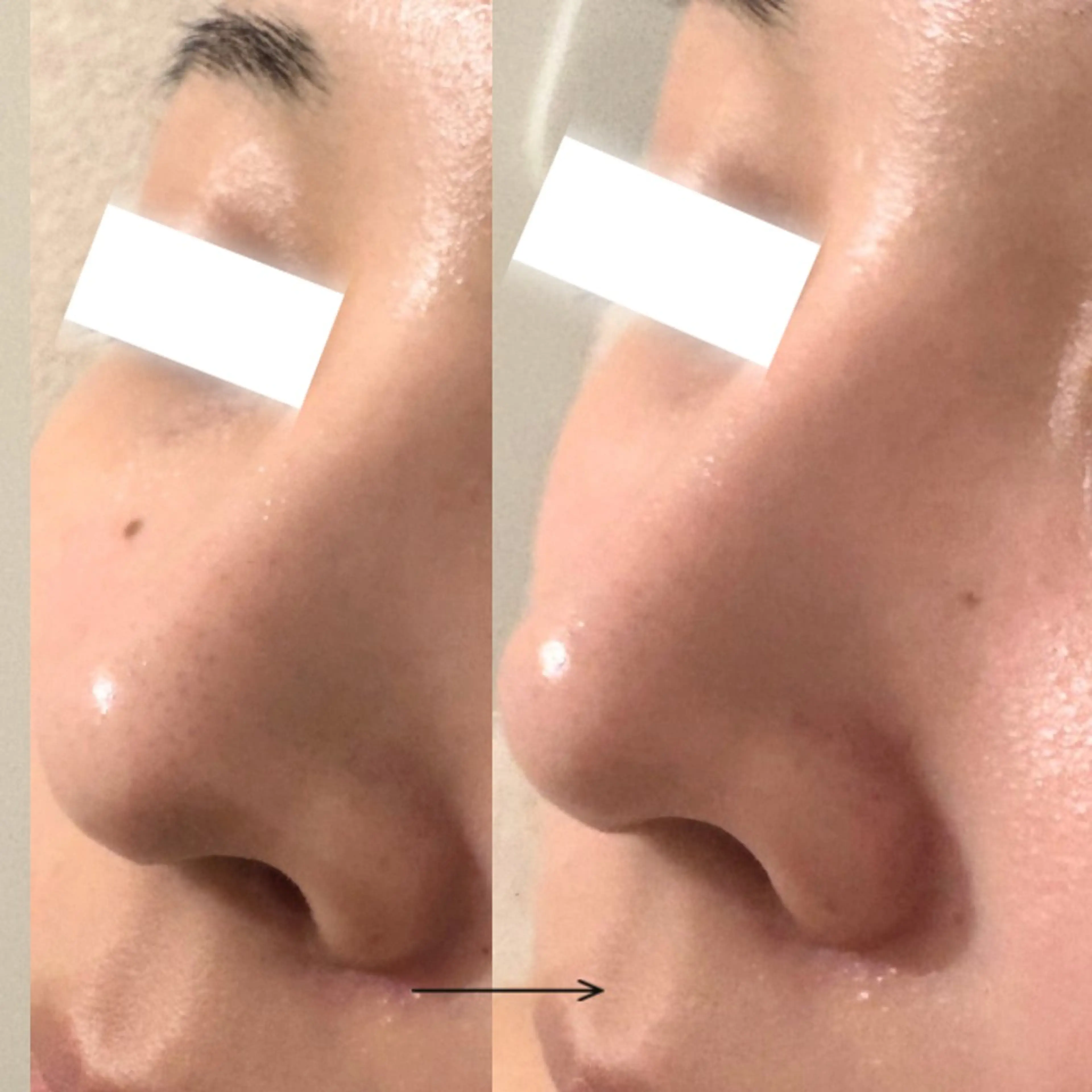 UEDA | POLA 天王寺のエステ・リラクイメージ