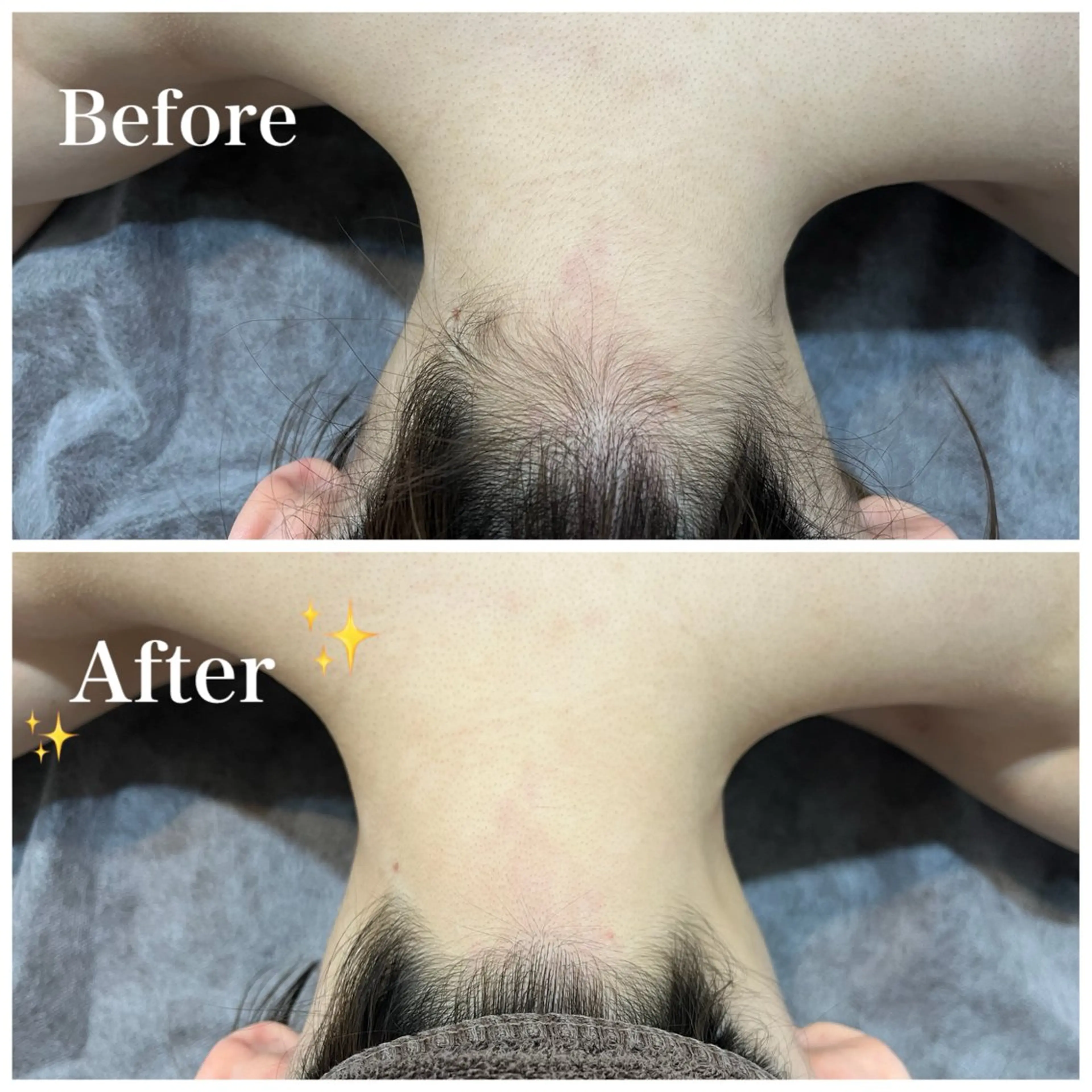 脱毛 脱毛サロン fam.豊澤柚良のエステ・リラクイメージ