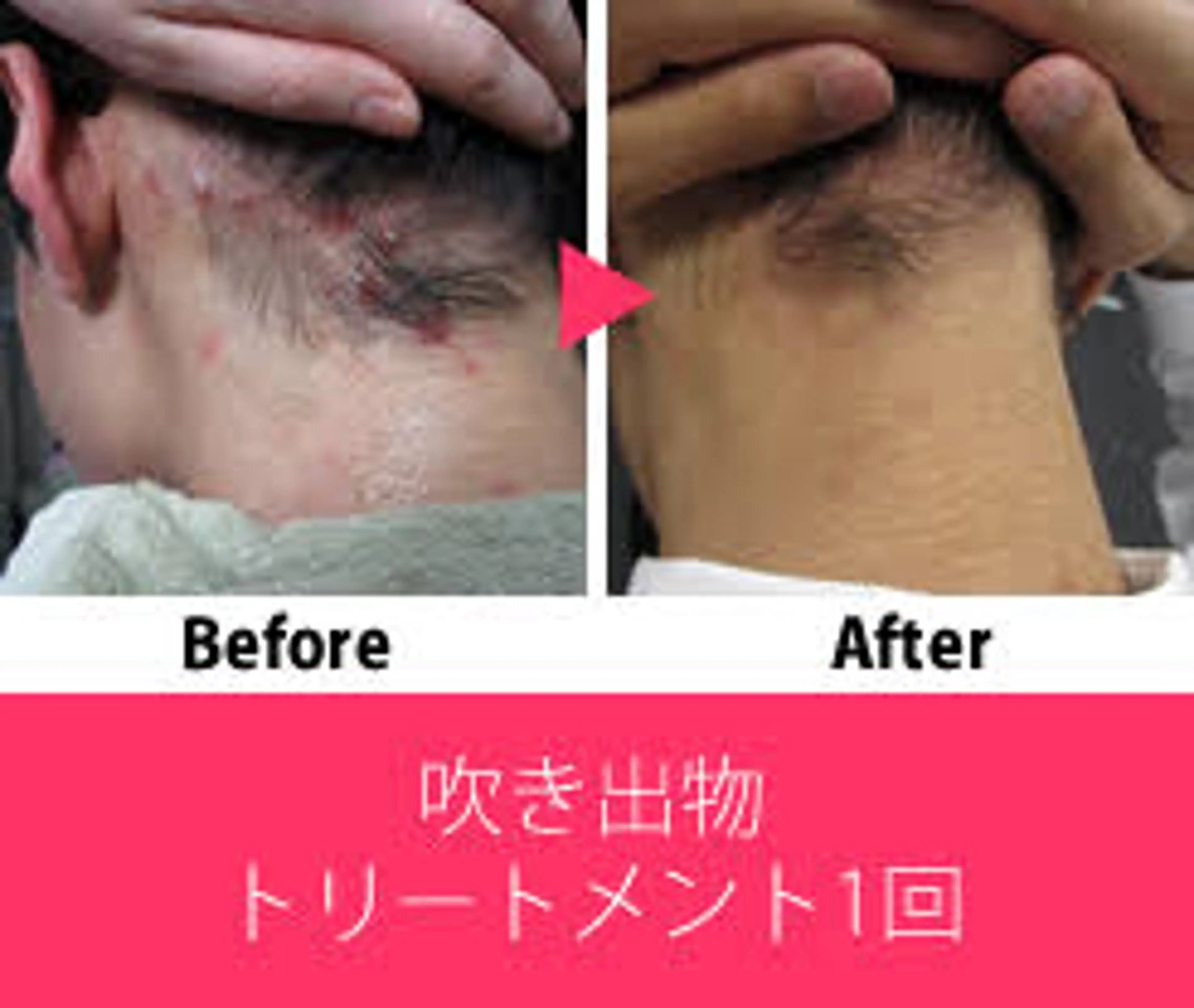 ビューティーラウンジ A&A✨佐藤✨のエステ・リラクイメージ