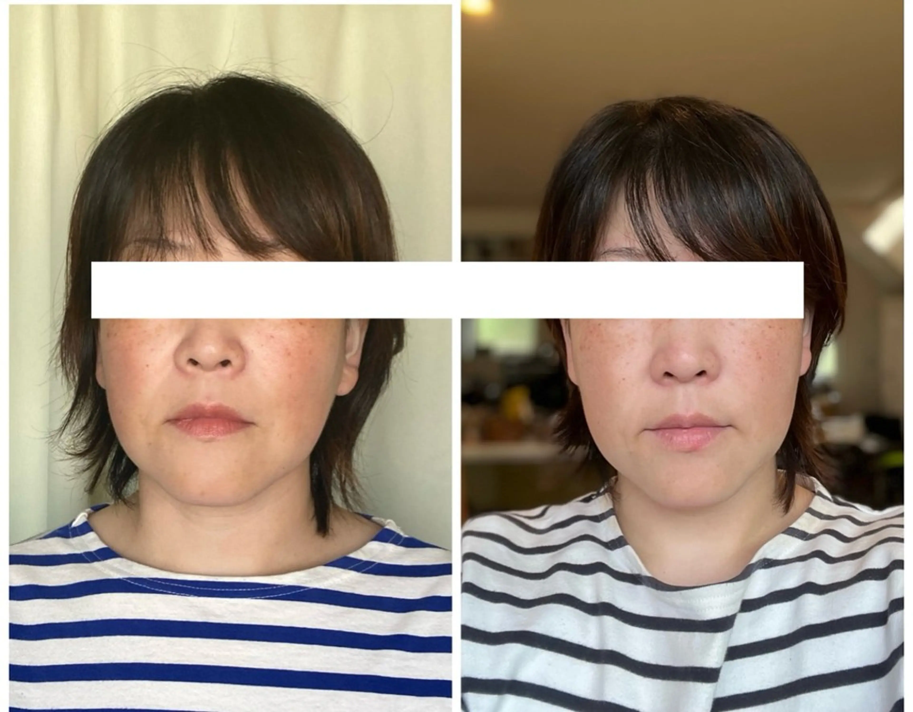 丸顔さんの救世主 高田 くみのエステ・リラクイメージ