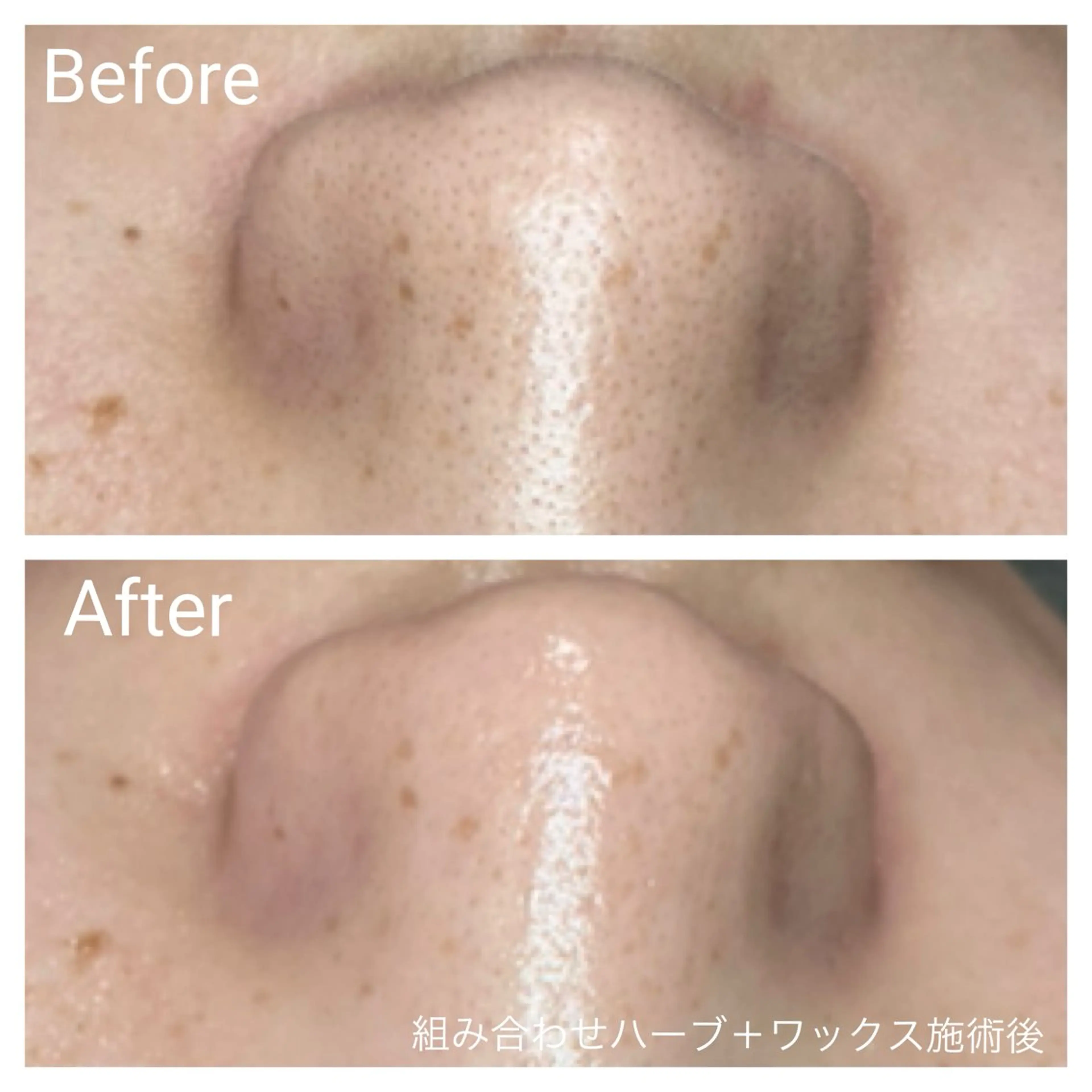 エステ リラク 深い肌悩み専門 フェイシャルサロンのエステ・リラクイメージ