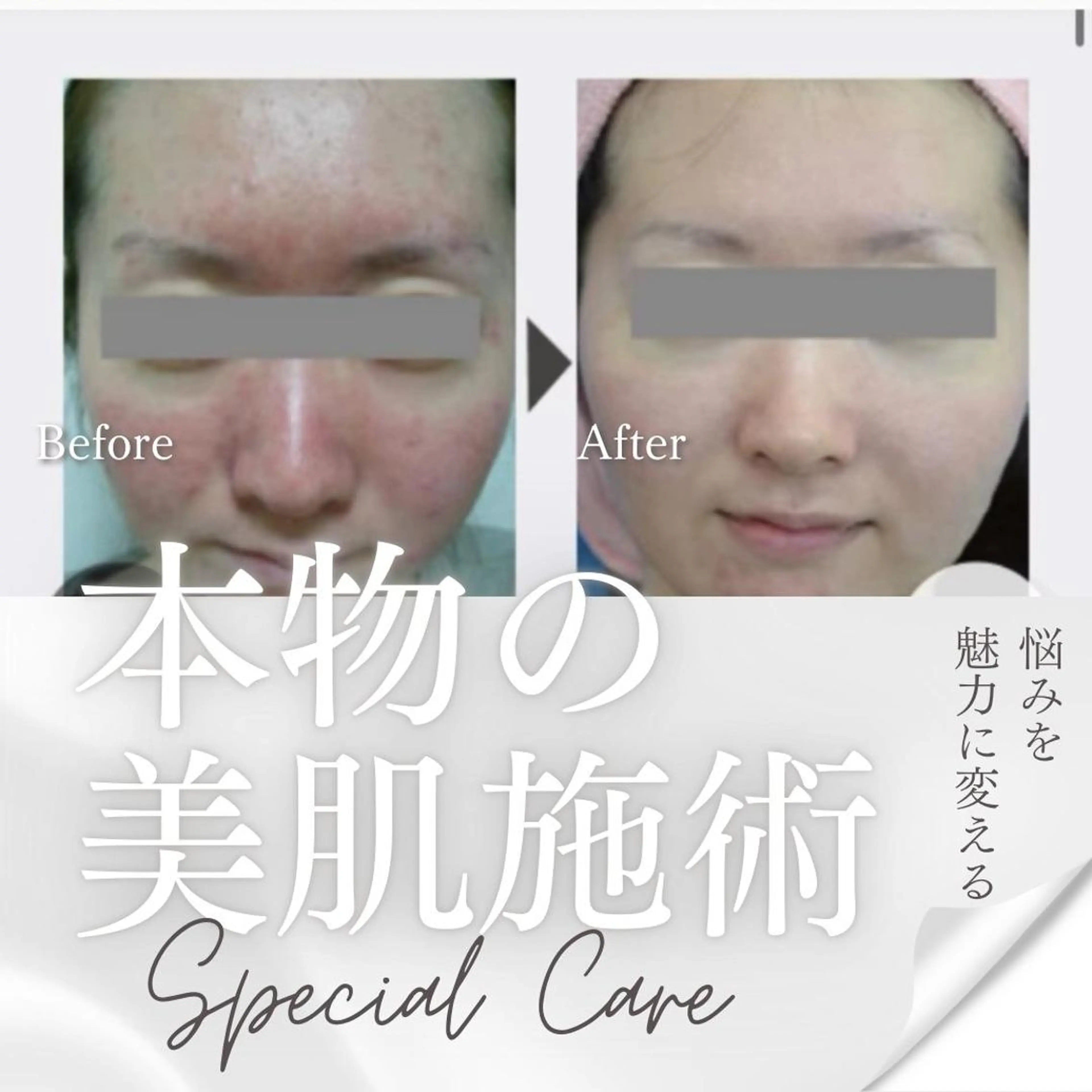 Lien オーナー　山口智嘉のエステ・リラクイメージ