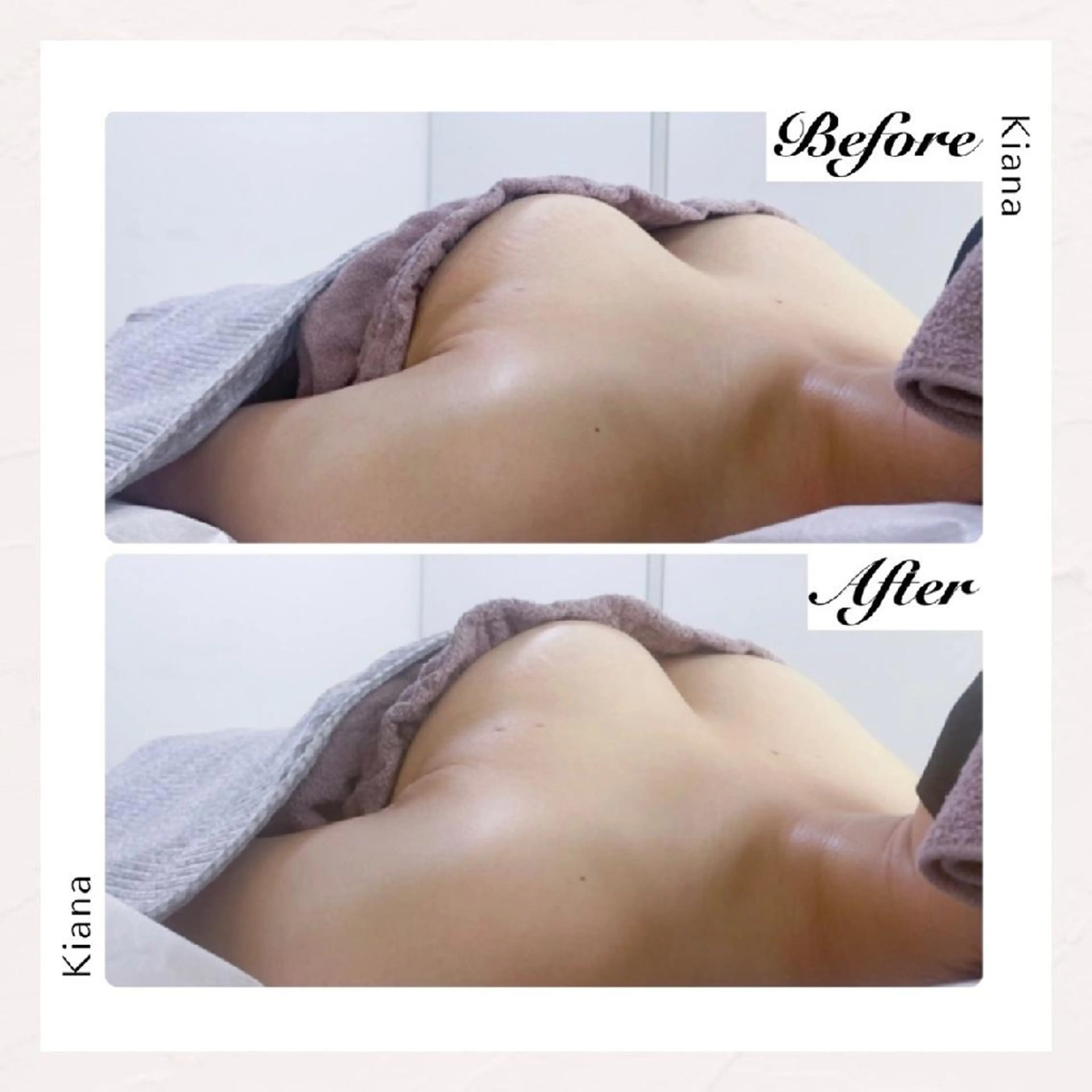 【バスト専門店 】 Kiana のエステ・リラクイメージ