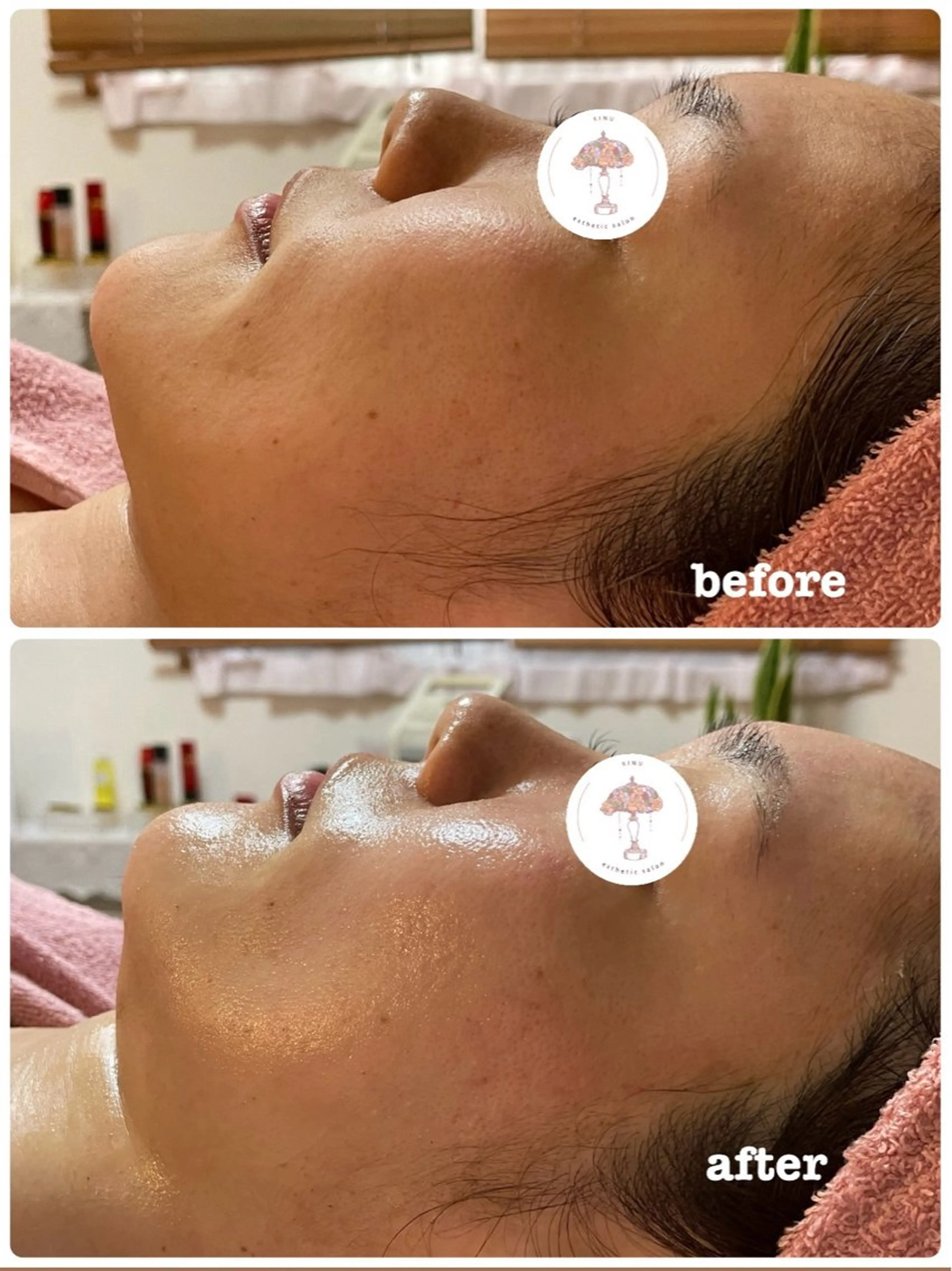 エステ 肌質改善専門店/絹々(きぬ)所属・心満たされる ハーブピーリング絹々のエステ・リラクイメージ