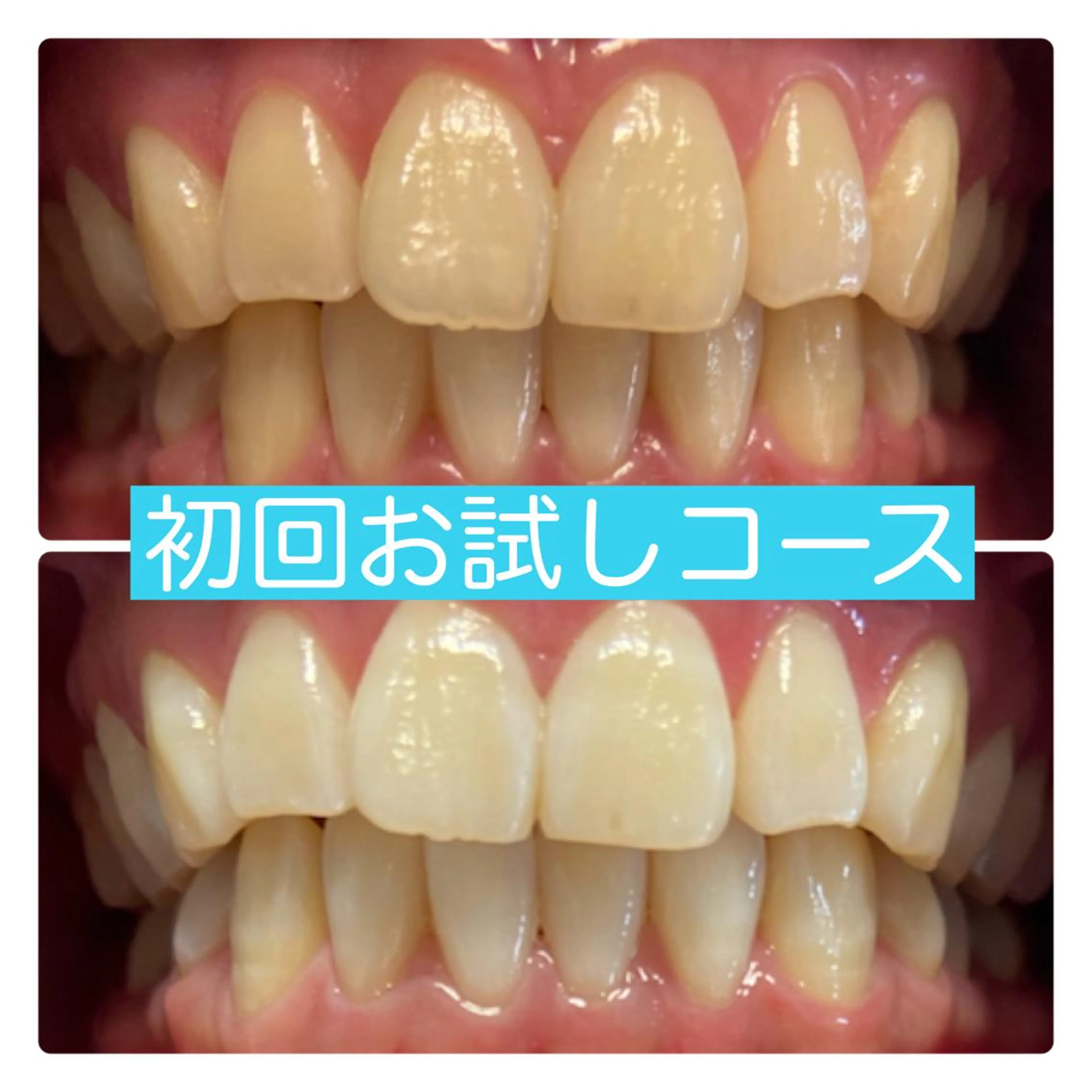 その他 ホワイトニングルーム 横浜店のその他イメージ